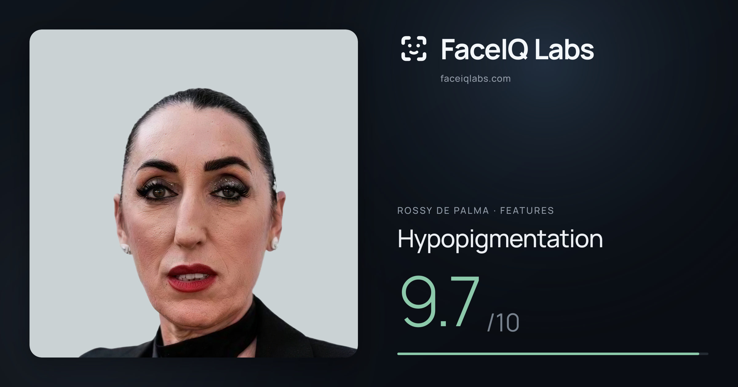 Rossy De Palma Hypopigmentation: 9.7/10, drawn on the photo