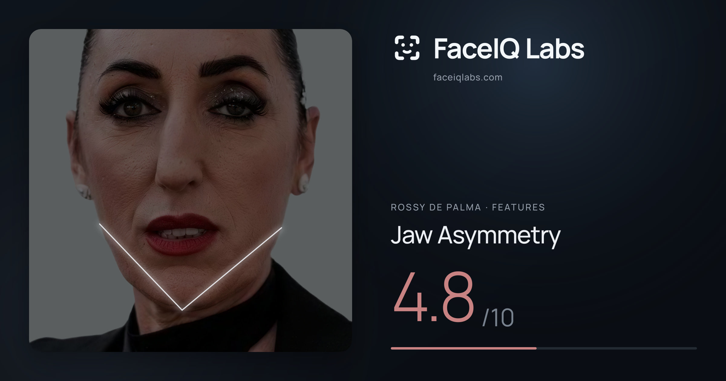 Rossy De Palma Jaw Asymmetry: 4.8/10, drawn on the photo