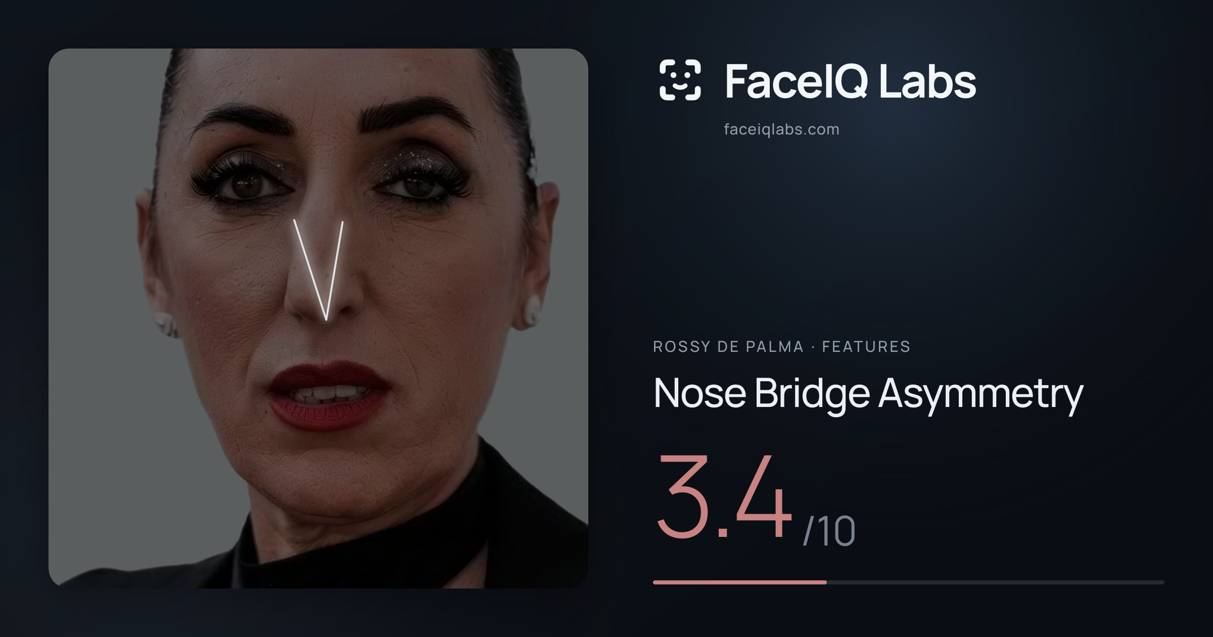 Rossy De Palma Nose Bridge Asymmetry: 3.4/10, drawn on the photo