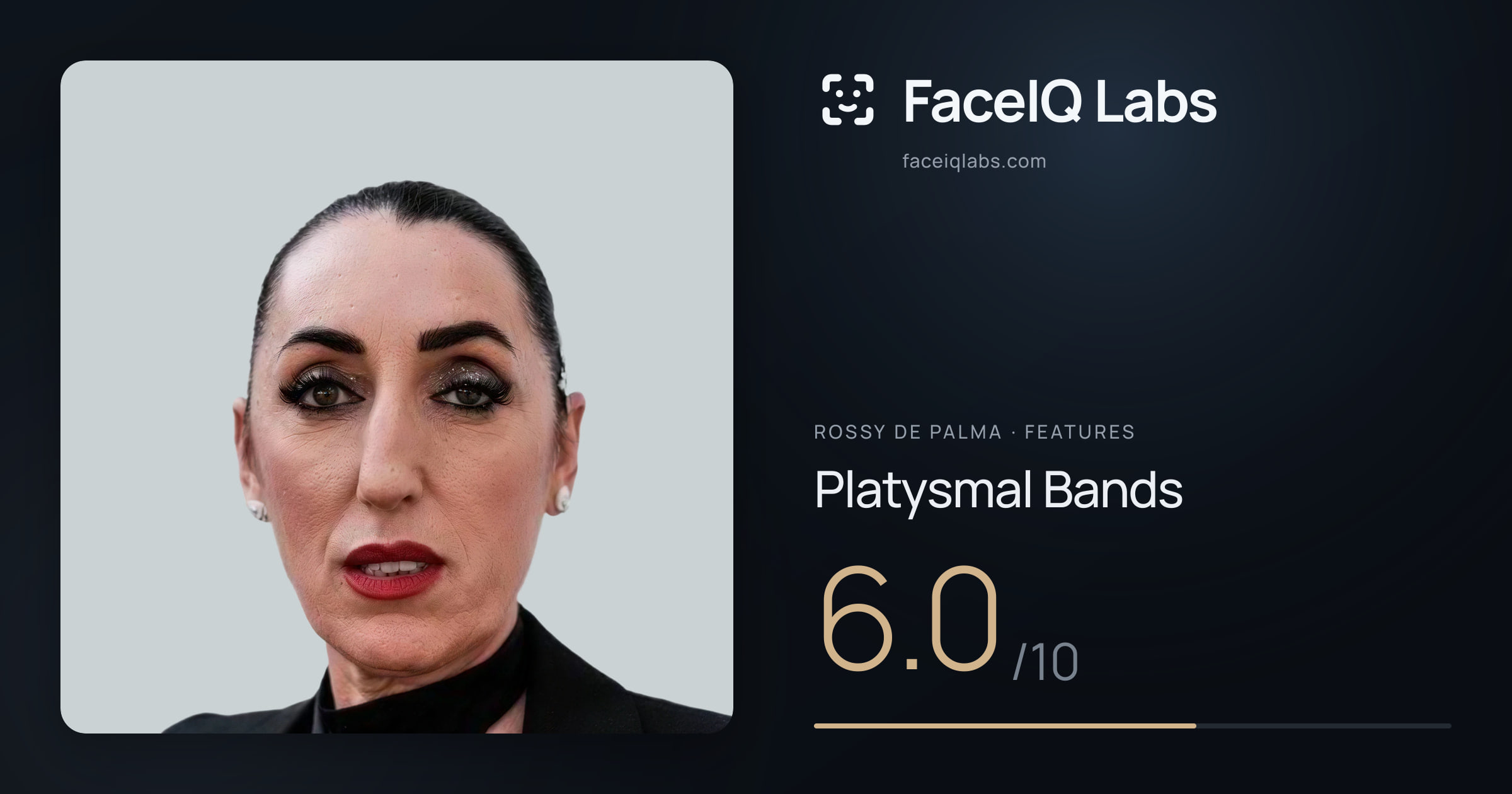 Rossy De Palma Platysmal Bands: 6.0/10, drawn on the photo