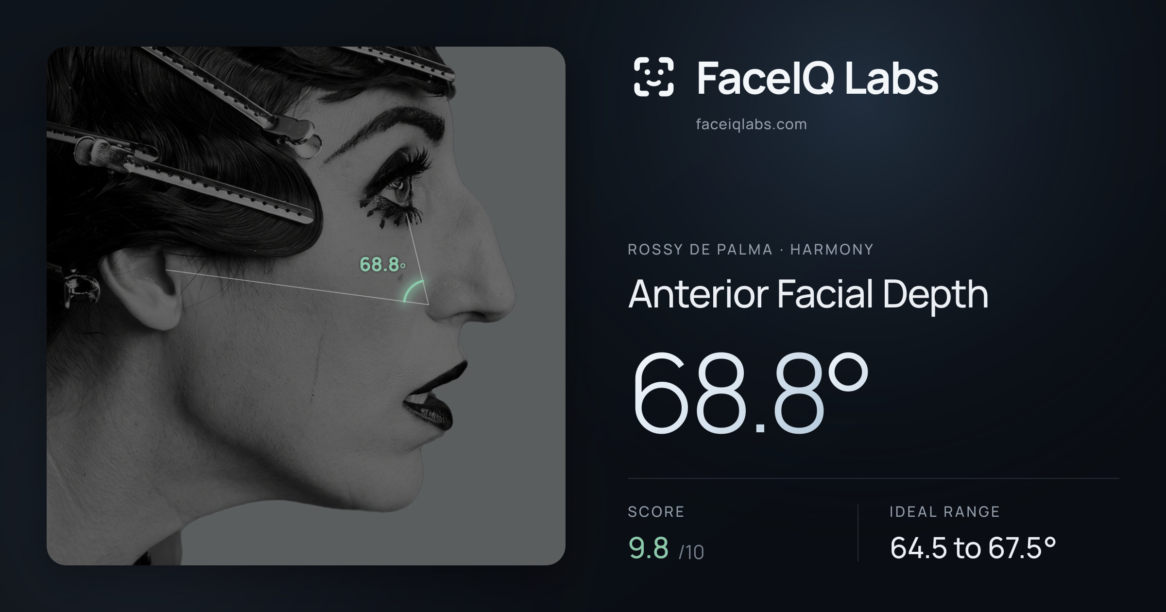 Rossy De Palma Anterior Facial Depth: 68.8°, drawn on the photo