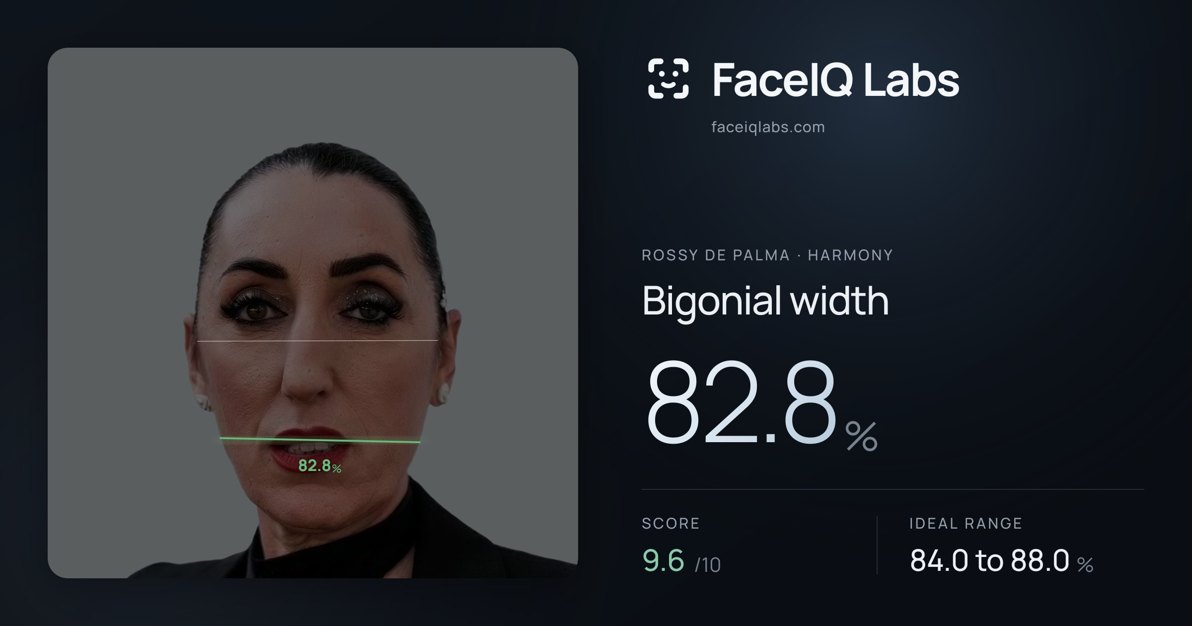 Rossy De Palma Bigonial width: 82.8%, drawn on the photo
