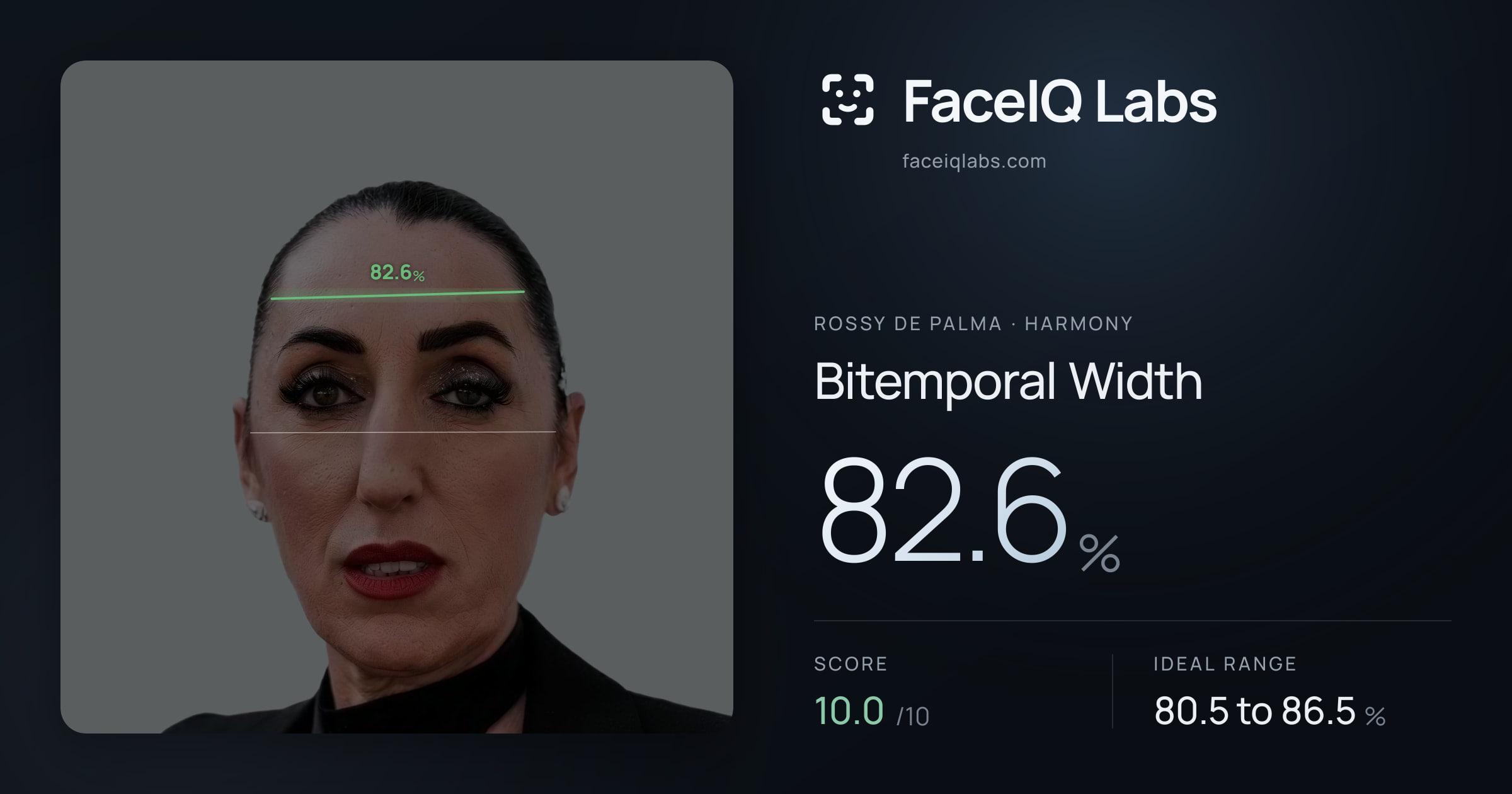 Rossy De Palma Bitemporal Width: 82.6%, drawn on the photo