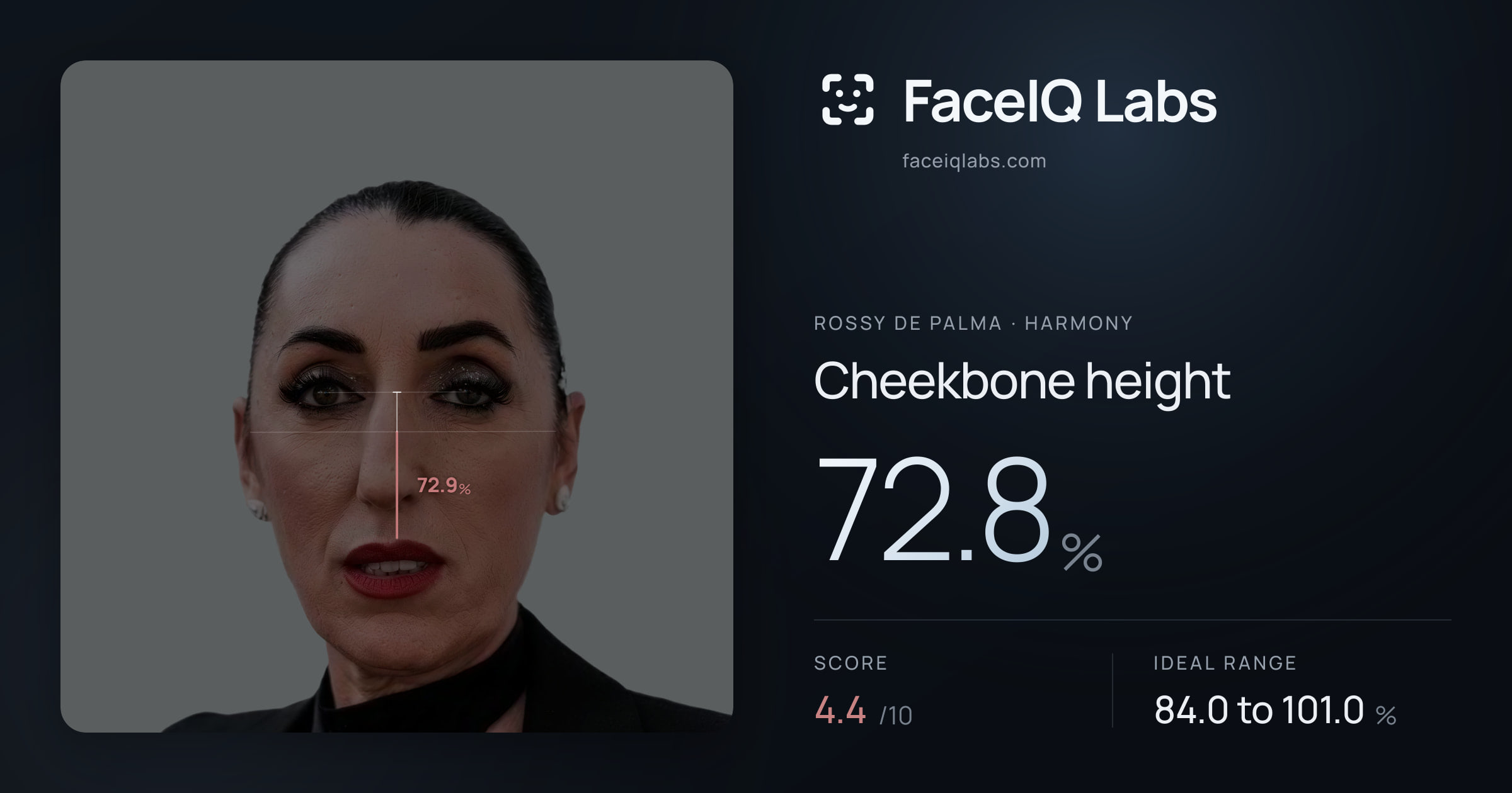 Rossy De Palma Cheekbone height: 72.8%, drawn on the photo