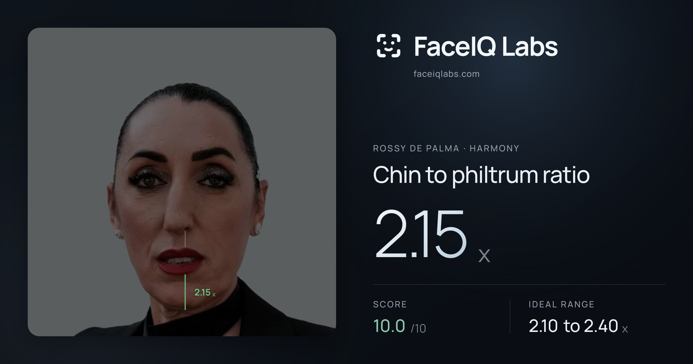 Rossy De Palma Chin to philtrum ratio: 2.15x, drawn on the photo