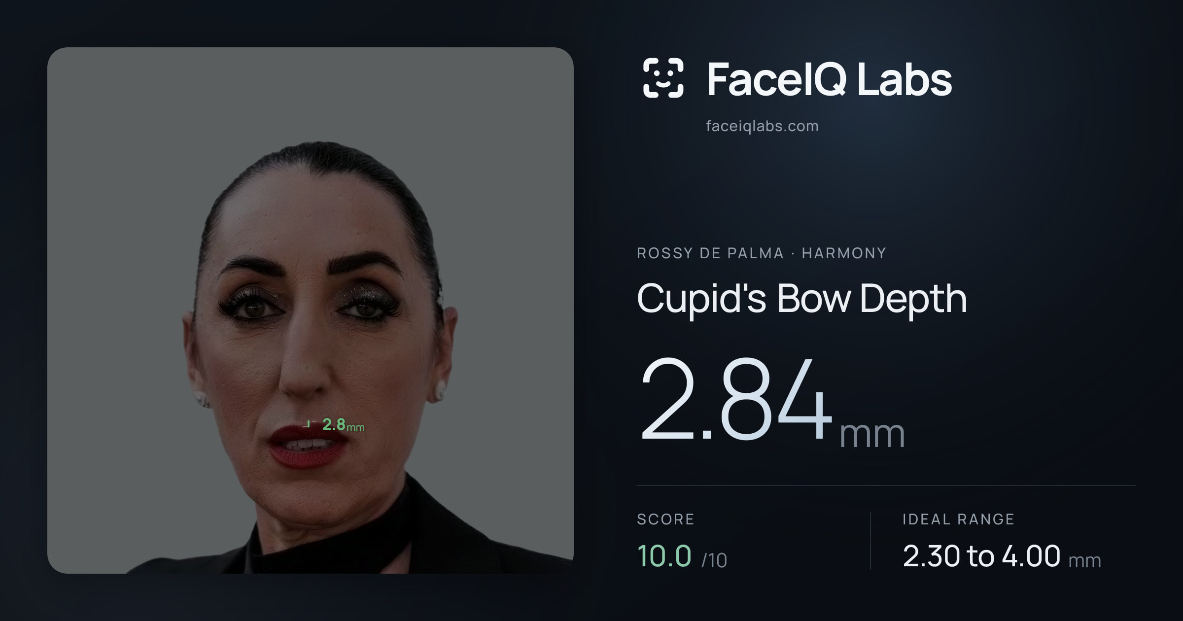 Rossy De Palma Cupid's Bow Depth: 2.84mm, drawn on the photo