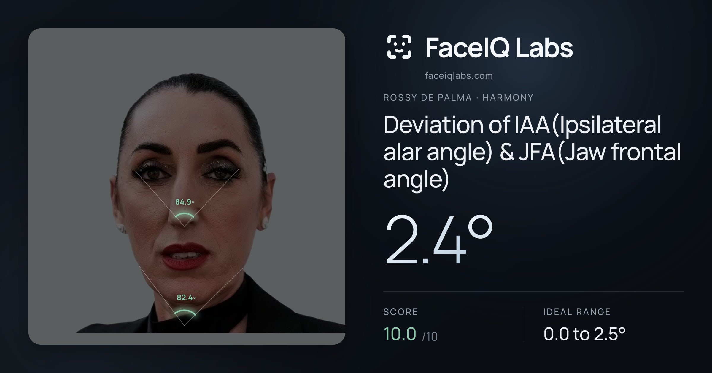 Rossy De Palma Deviation of IAA(Ipsilateral alar angle) & JFA(Jaw frontal angle): 2.4°, drawn on the photo