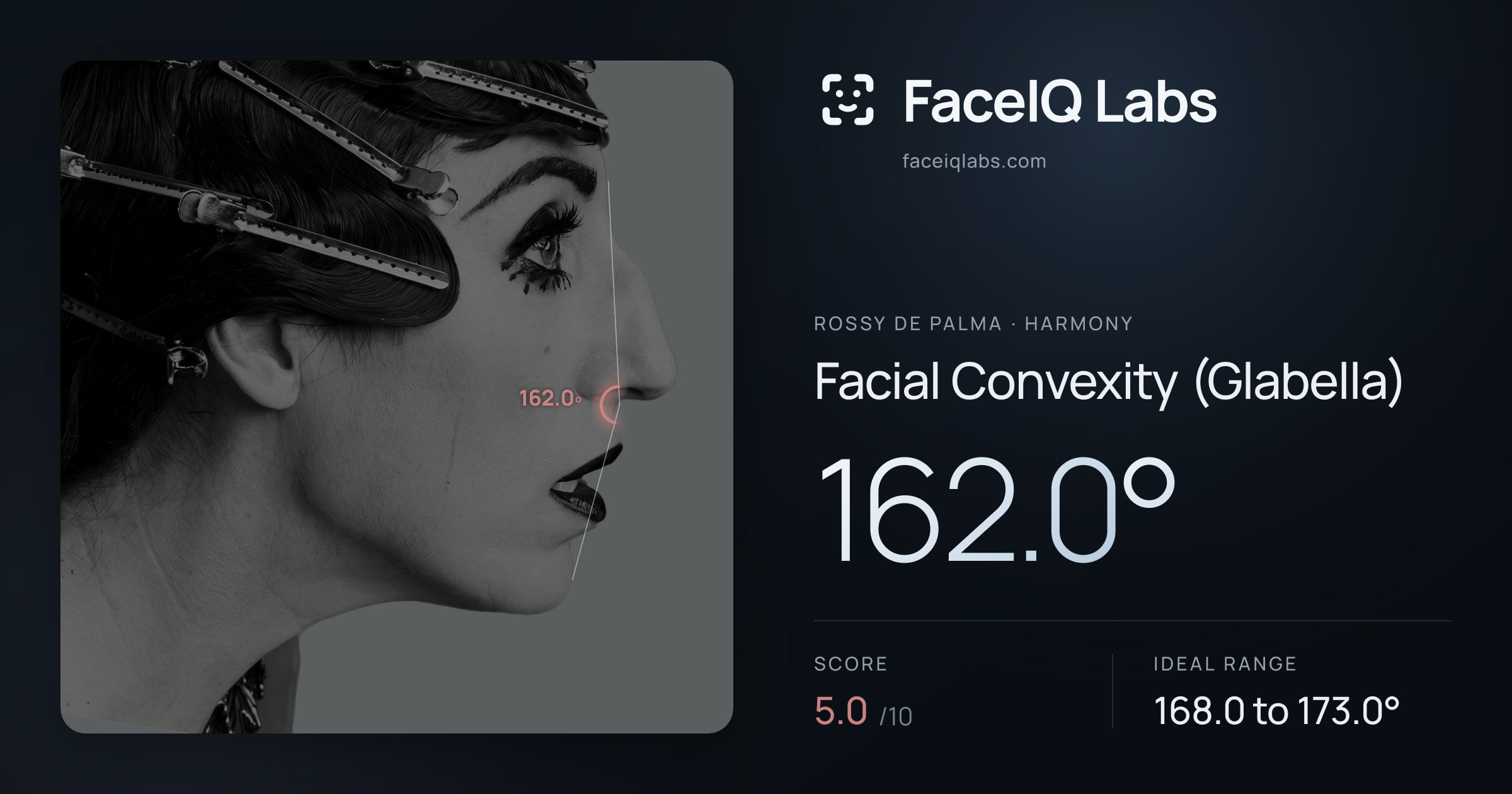 Rossy De Palma Facial Convexity (Glabella): 162.0°, drawn on the photo
