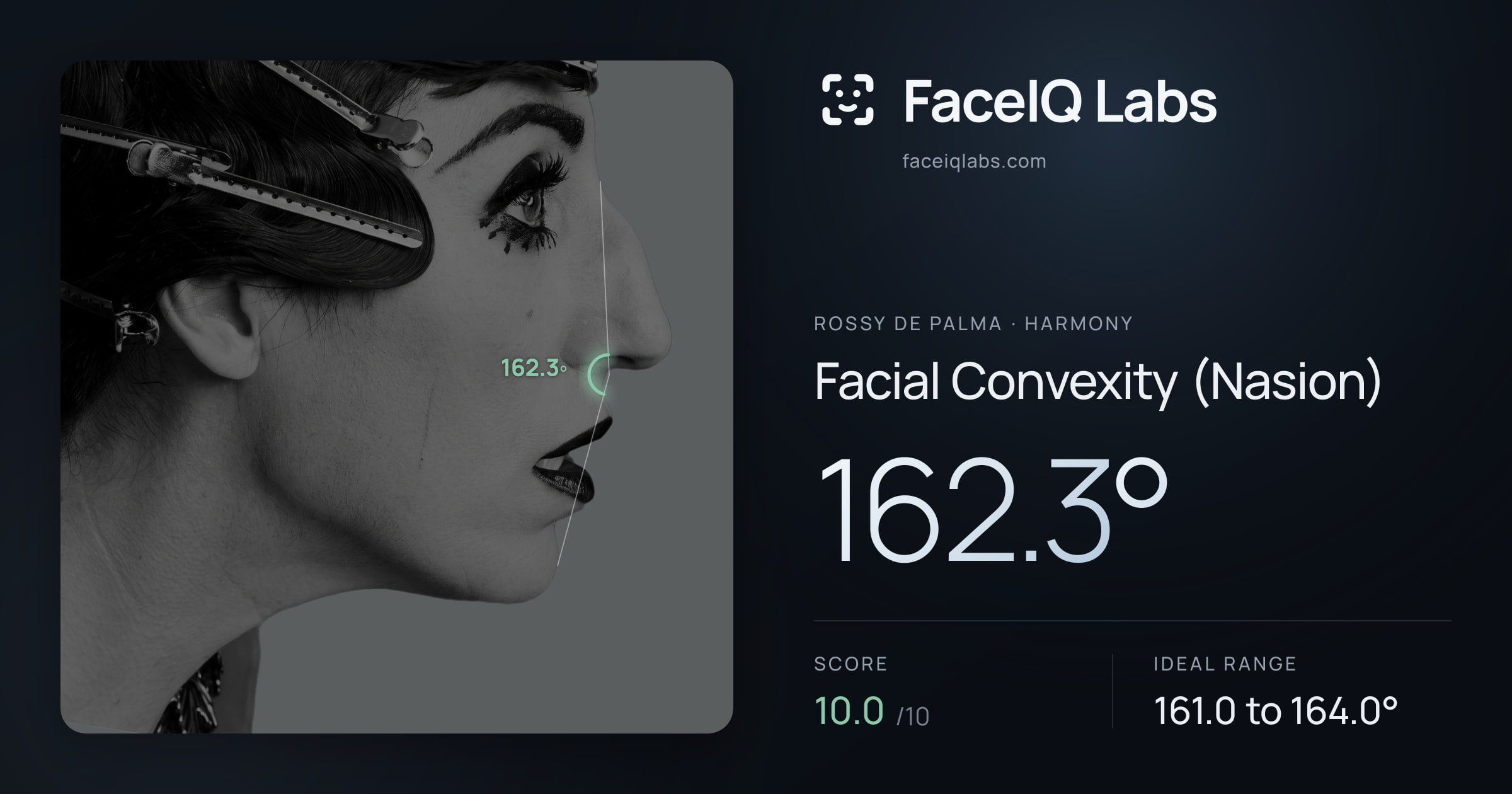 Rossy De Palma Facial Convexity (Nasion): 162.3°, drawn on the photo