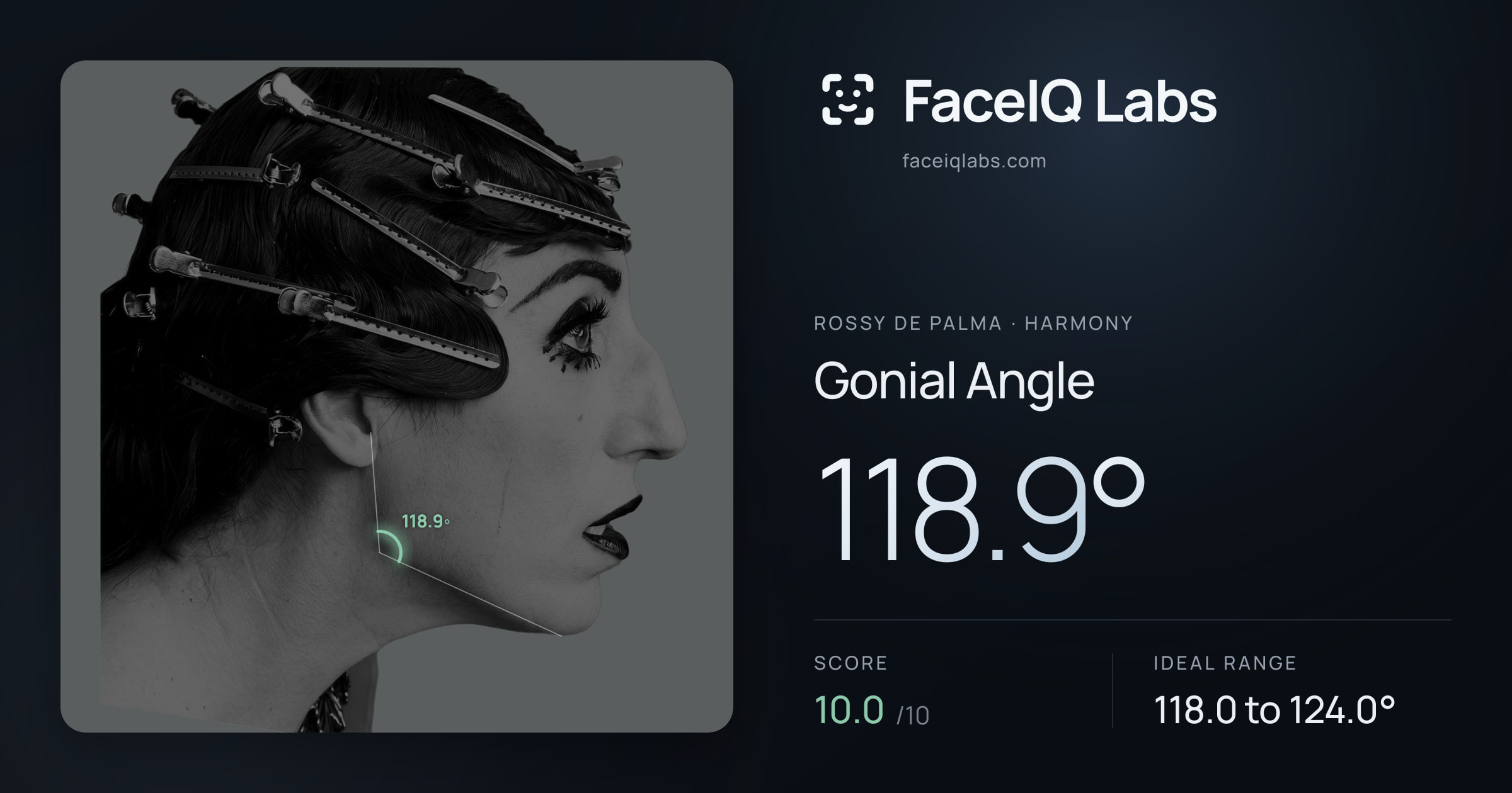 Rossy De Palma Gonial Angle: 118.9°, drawn on the photo