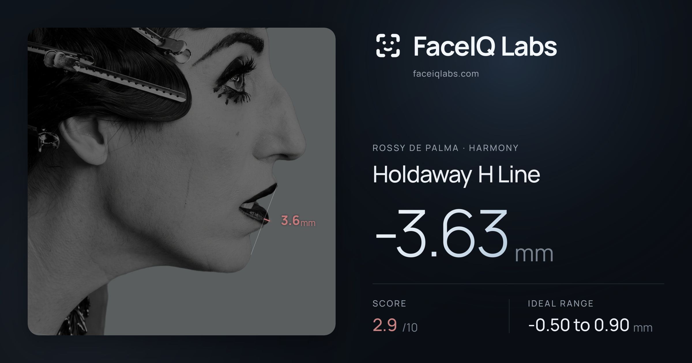 Rossy De Palma Holdaway H Line: -3.63mm, drawn on the photo