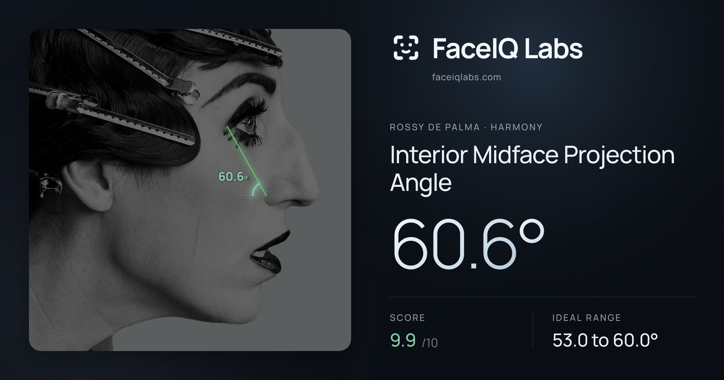 Rossy De Palma Interior Midface Projection Angle: 60.6°, drawn on the photo