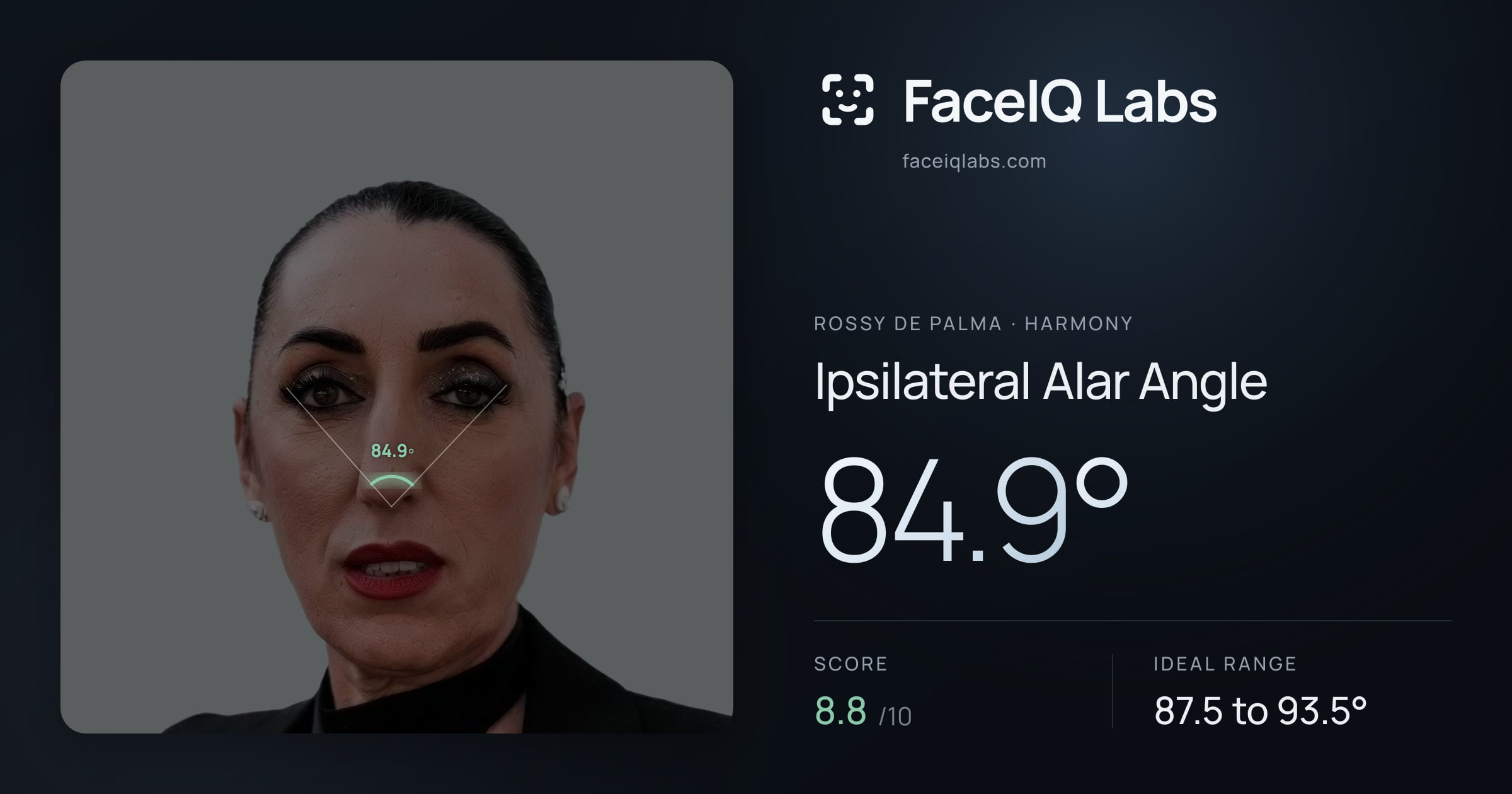 Rossy De Palma Ipsilateral Alar Angle: 84.9°, drawn on the photo