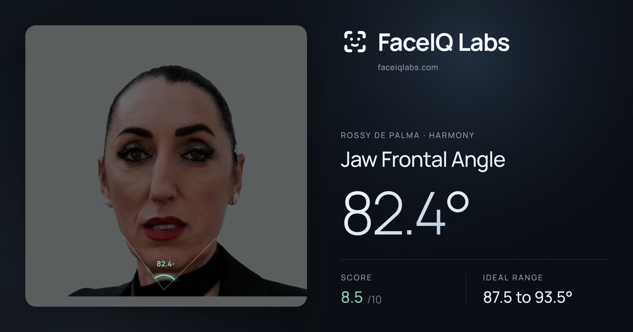 Rossy De Palma Jaw Frontal Angle: 82.4°, drawn on the photo