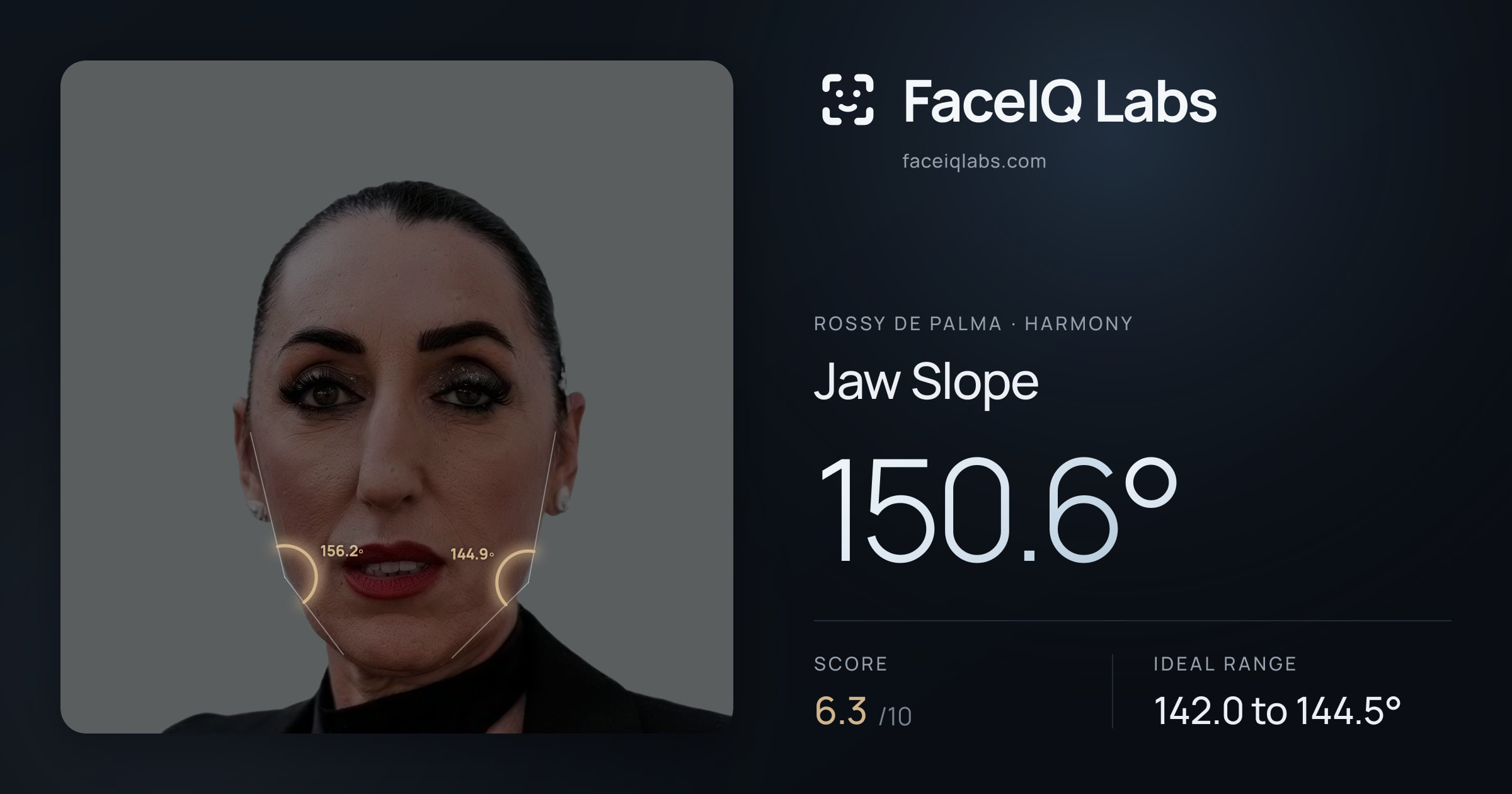 Rossy De Palma Jaw Slope: 150.6°, drawn on the photo