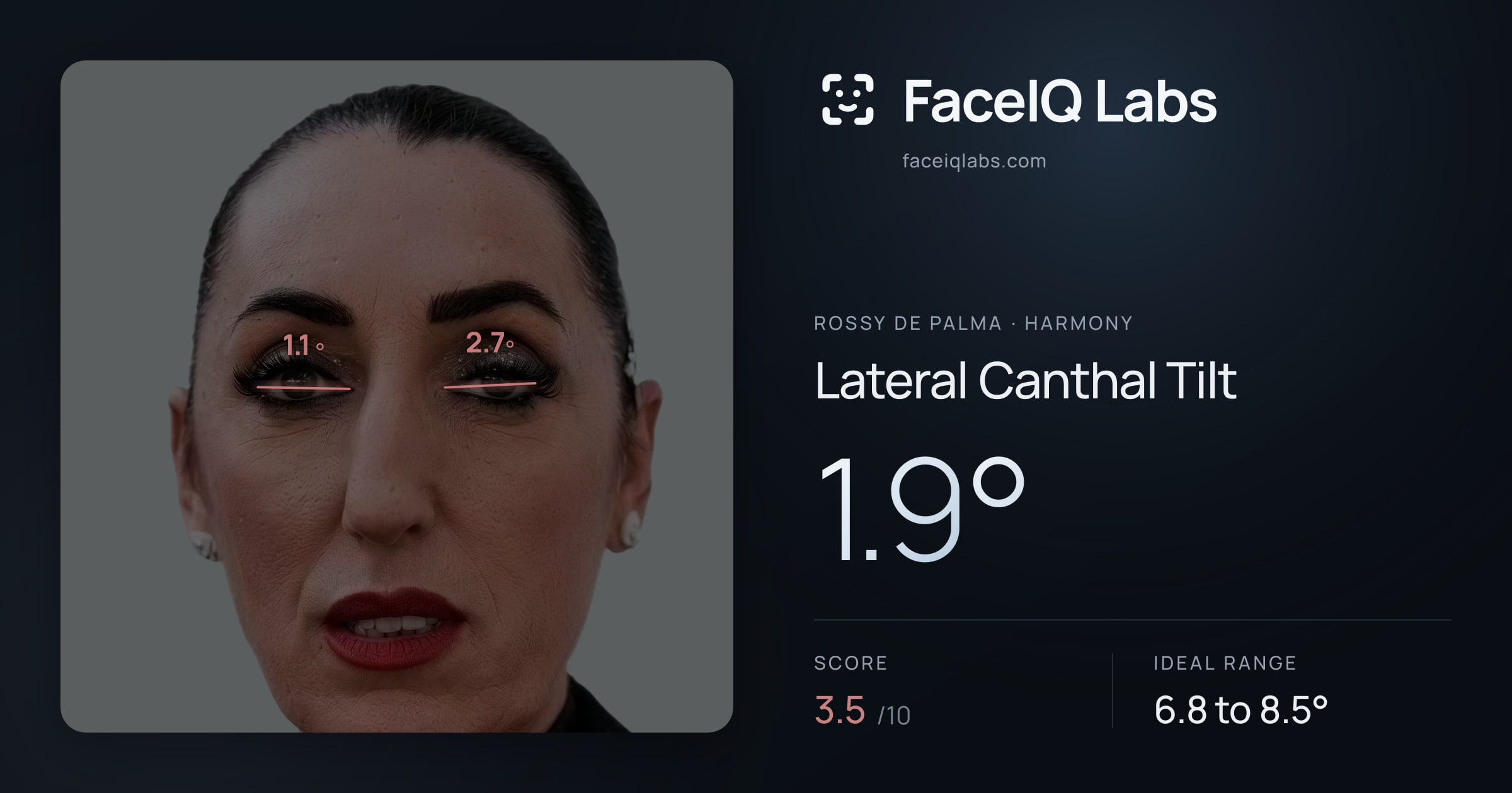 Rossy De Palma Lateral Canthal Tilt: 1.9°, drawn on the photo