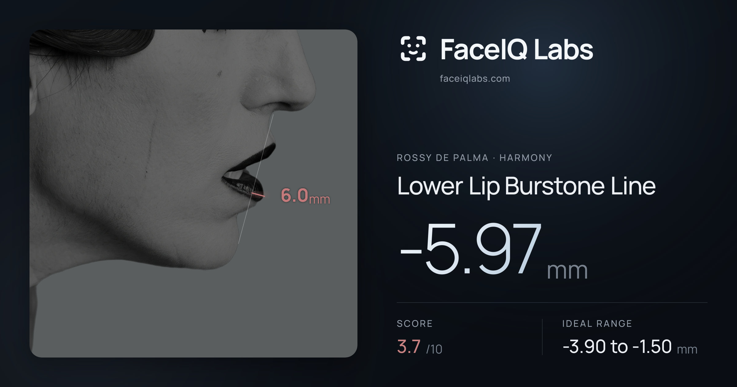 Rossy De Palma Lower Lip Burstone Line: -5.97mm, drawn on the photo
