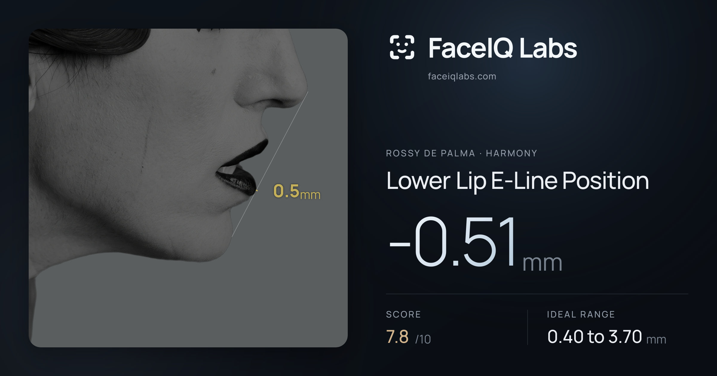 Rossy De Palma Lower Lip E-Line Position: -0.51mm, drawn on the photo