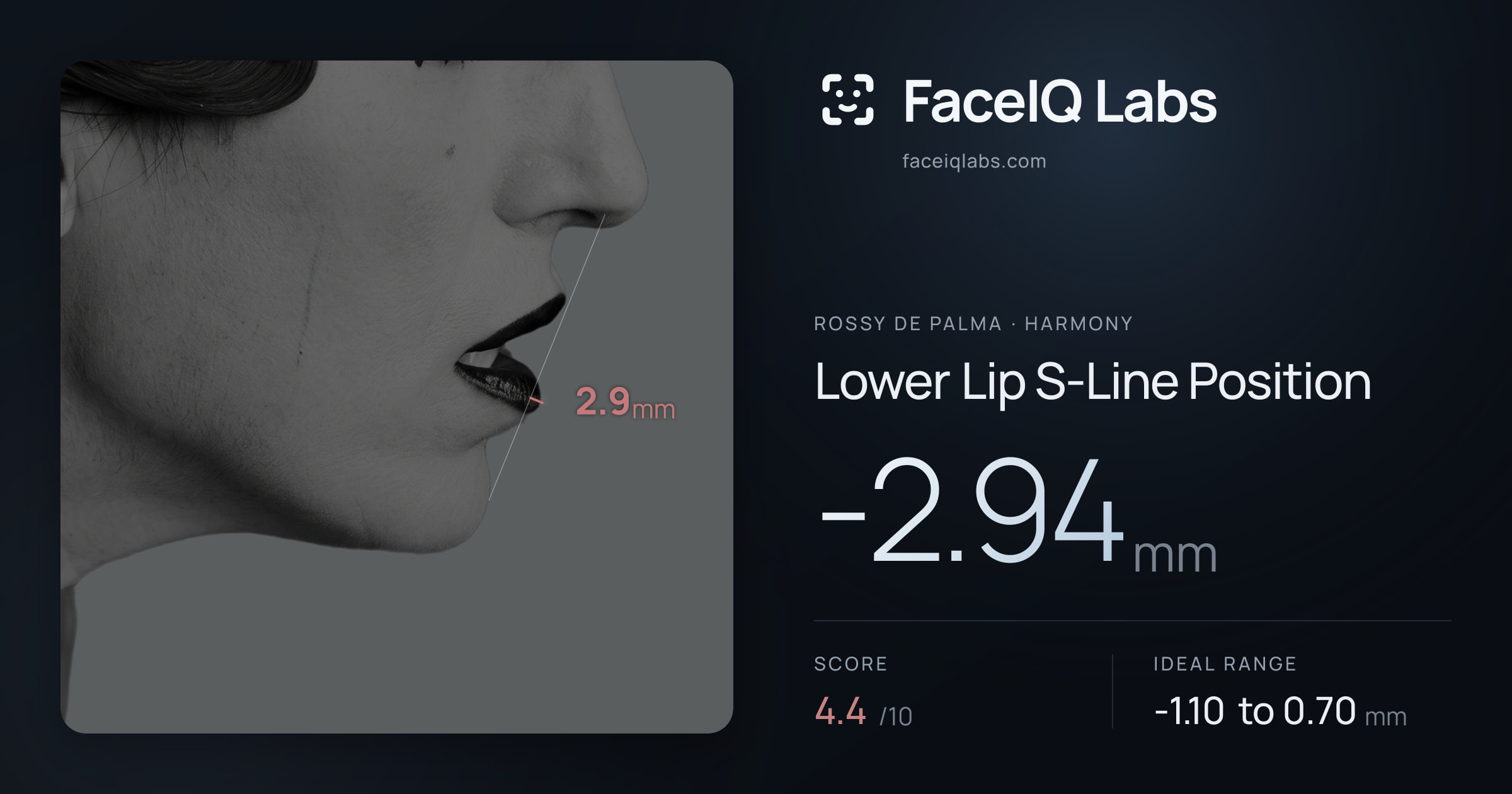 Rossy De Palma Lower Lip S-Line Position: -2.94mm, drawn on the photo