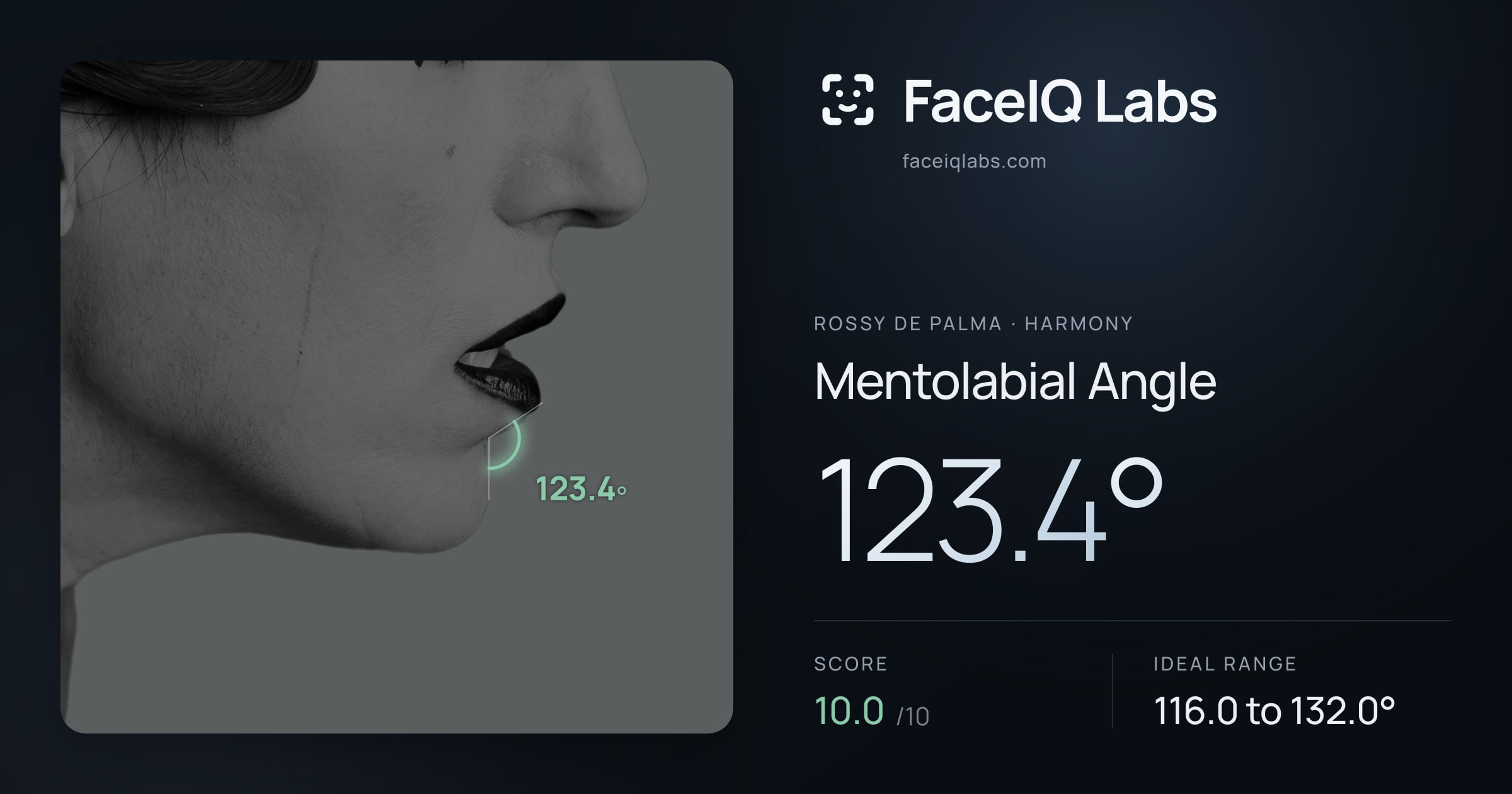 Rossy De Palma Mentolabial Angle: 123.4°, drawn on the photo