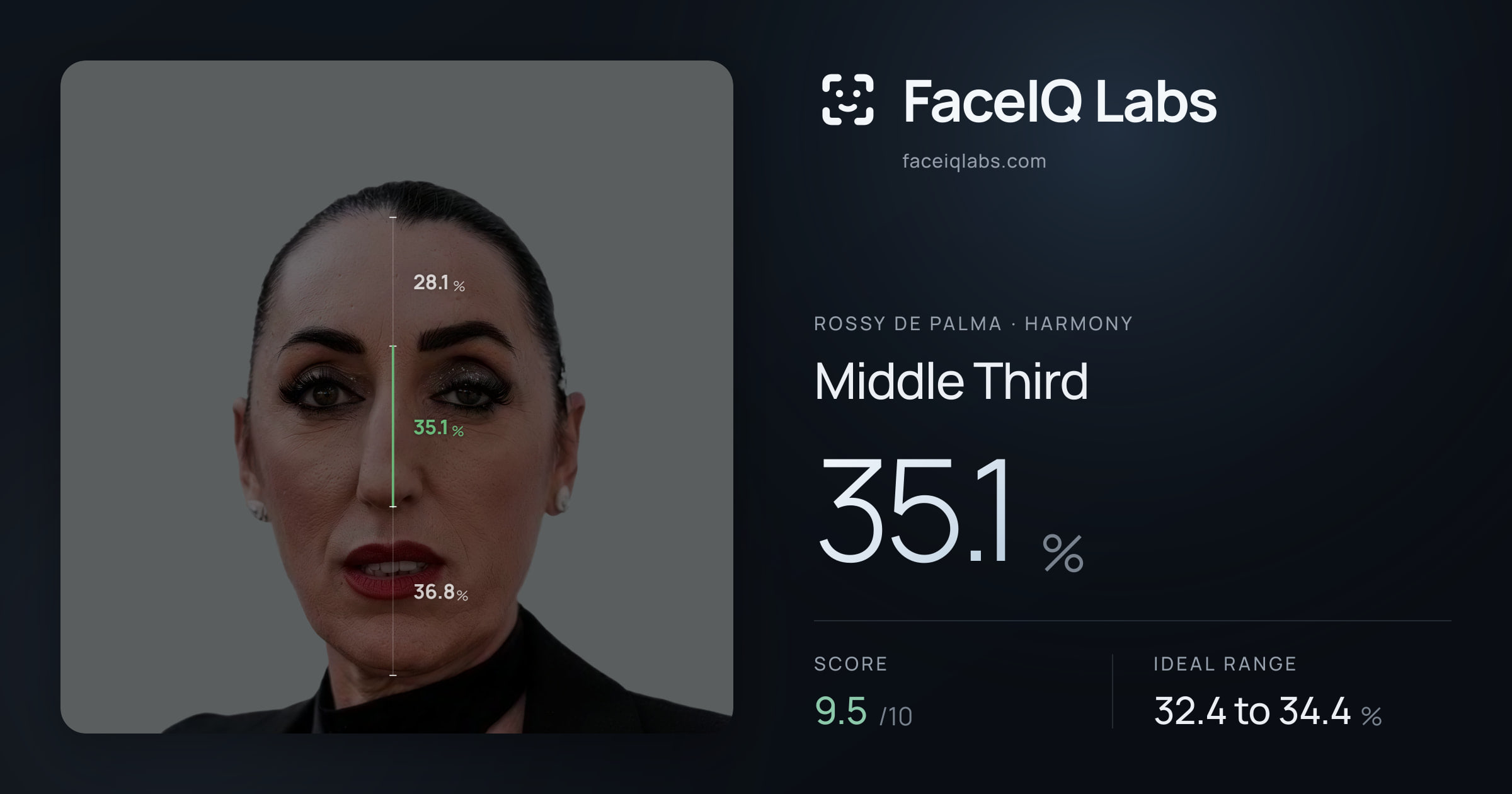 Rossy De Palma Middle Third: 35.1%, drawn on the photo