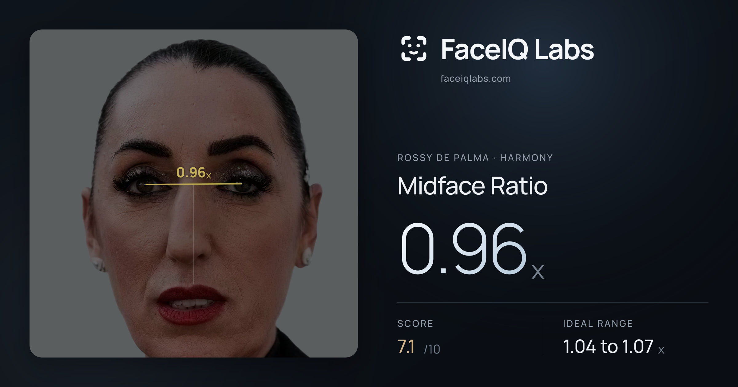 Rossy De Palma Midface Ratio: 0.96x, drawn on the photo