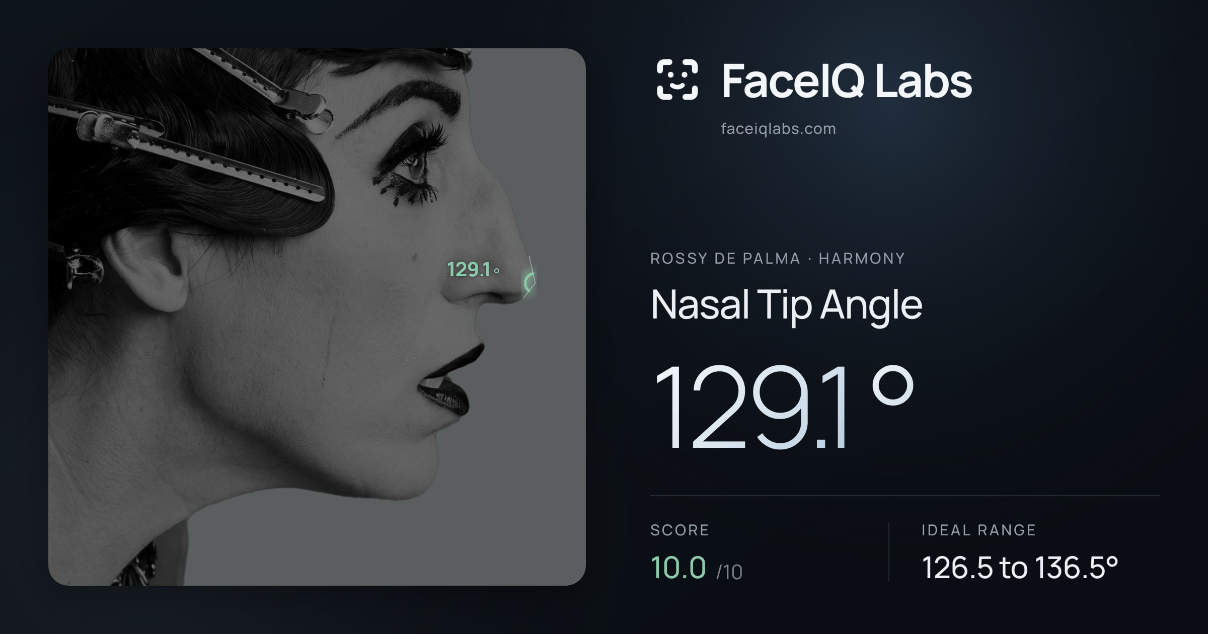 Rossy De Palma Nasal Tip Angle: 129.1°, drawn on the photo