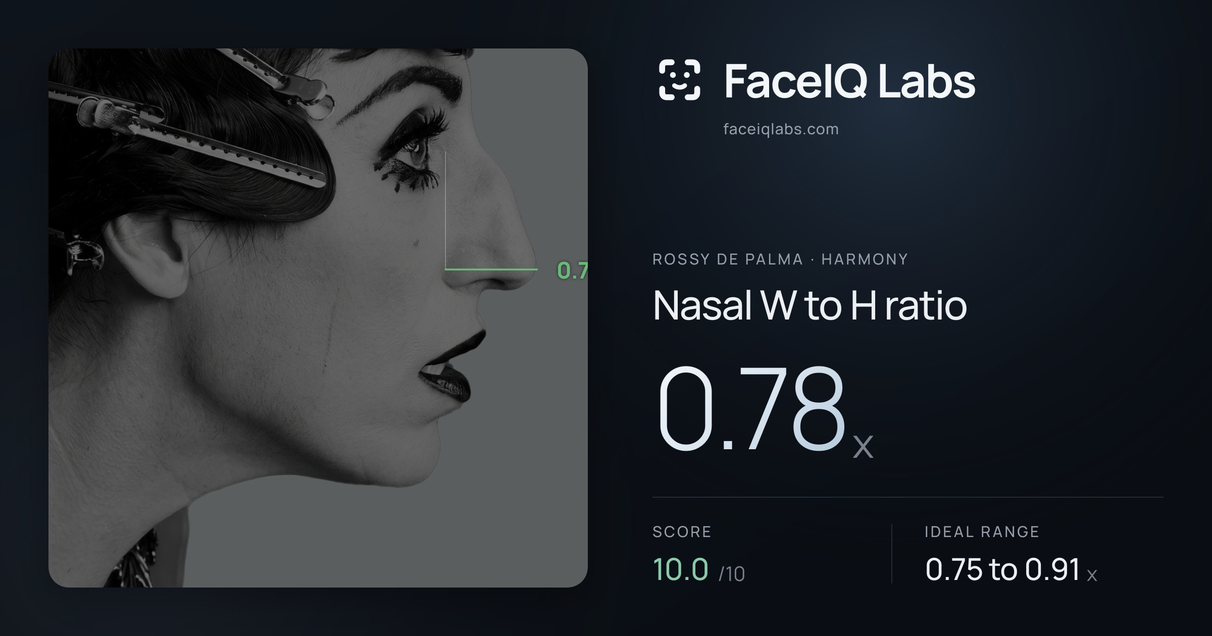 Rossy De Palma Nasal W to H ratio: 0.78x, drawn on the photo