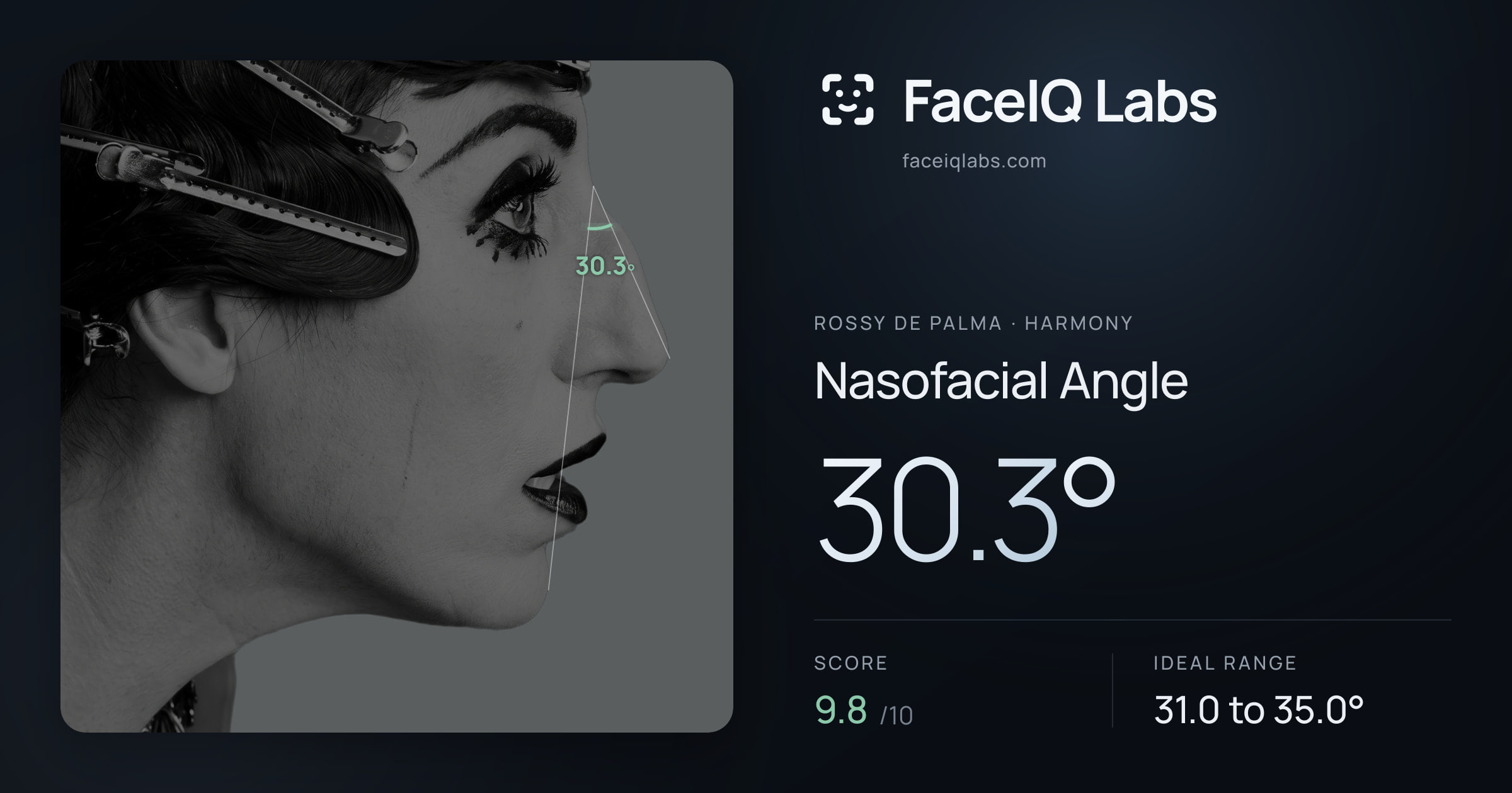 Rossy De Palma Nasofacial Angle: 30.3°, drawn on the photo