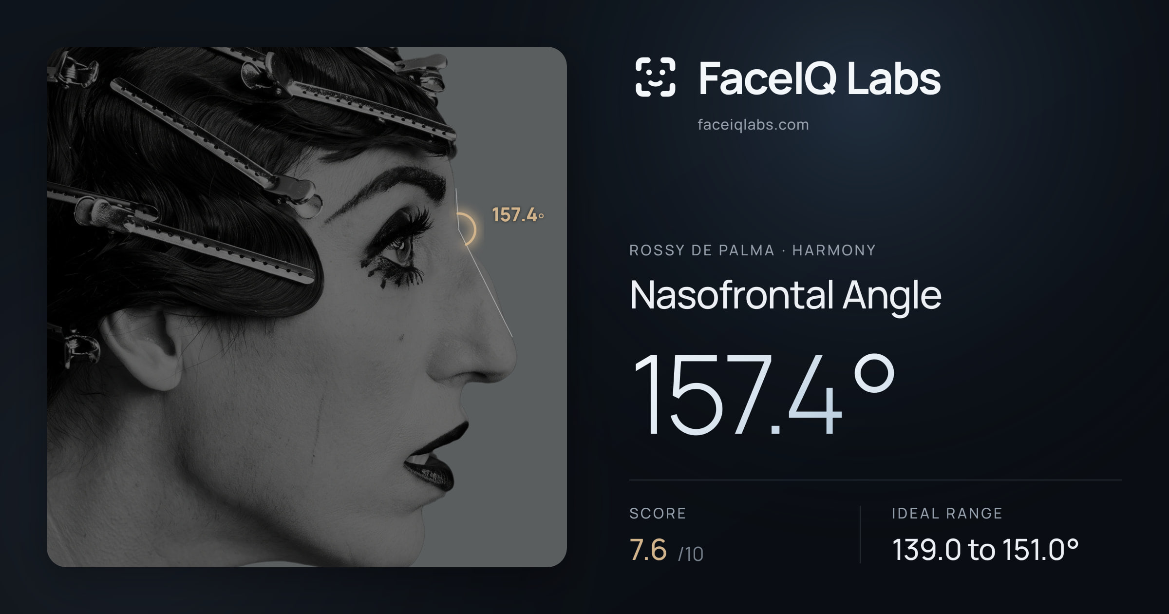 Rossy De Palma Nasofrontal Angle: 157.4°, drawn on the photo