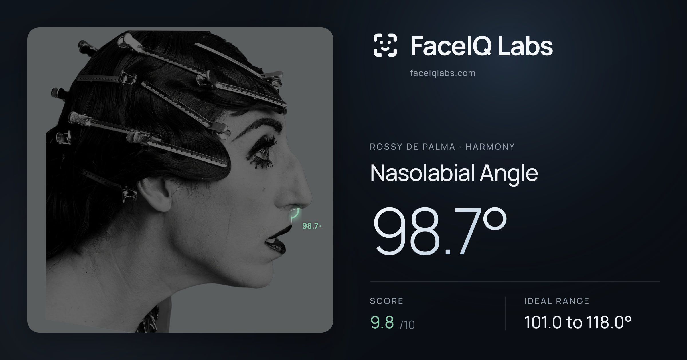 Rossy De Palma Nasolabial Angle: 98.7°, drawn on the photo