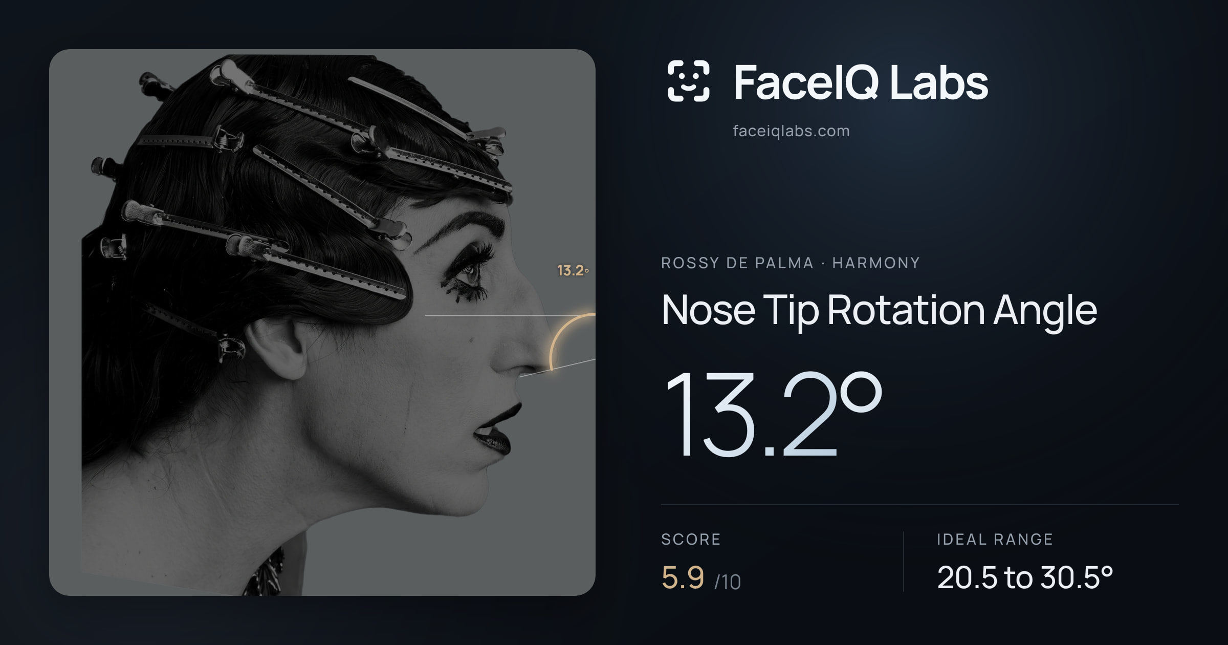 Rossy De Palma Nose Tip Rotation Angle: 13.2°, drawn on the photo