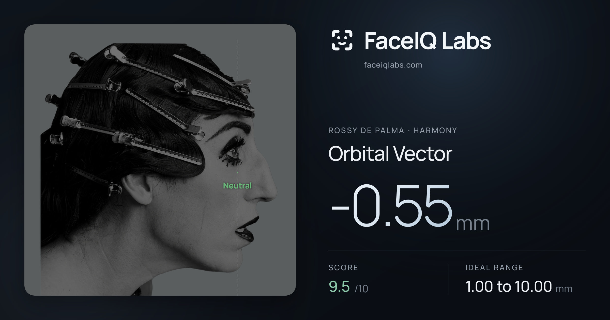 Rossy De Palma Orbital Vector: -0.55mm, drawn on the photo