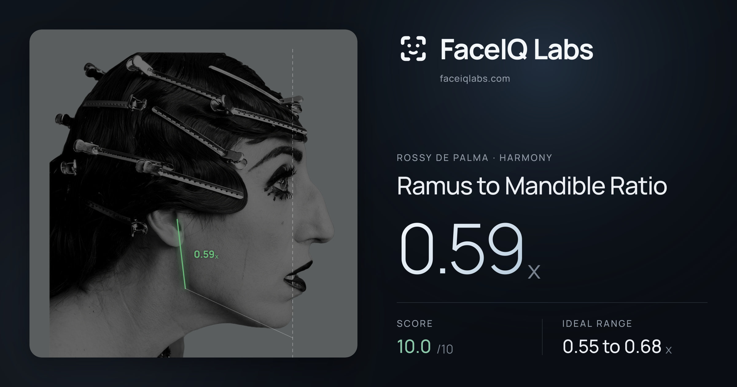 Rossy De Palma Ramus to Mandible Ratio: 0.59x, drawn on the photo
