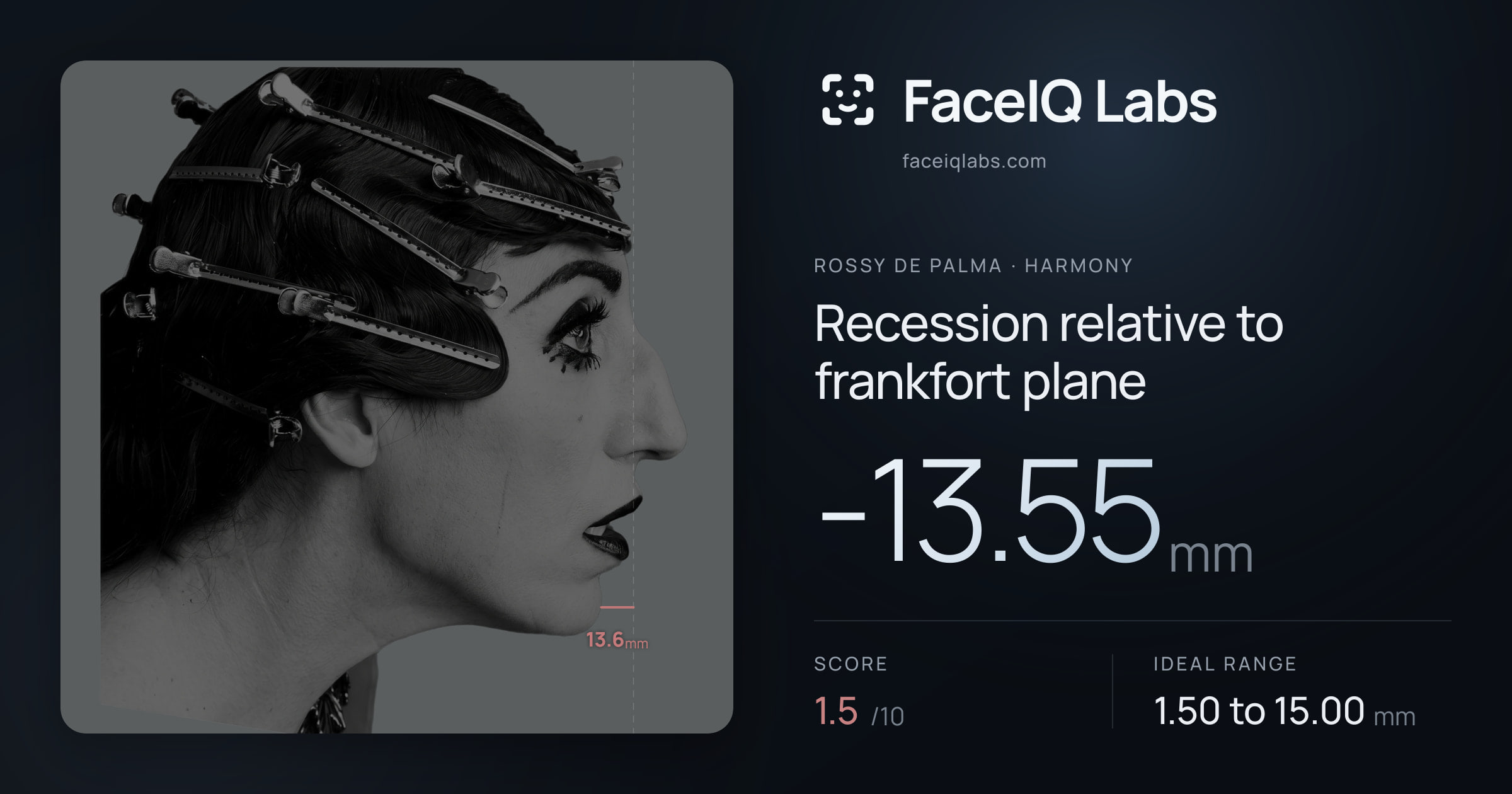 Rossy De Palma Recession relative to frankfort plane: -13.55mm, drawn on the photo