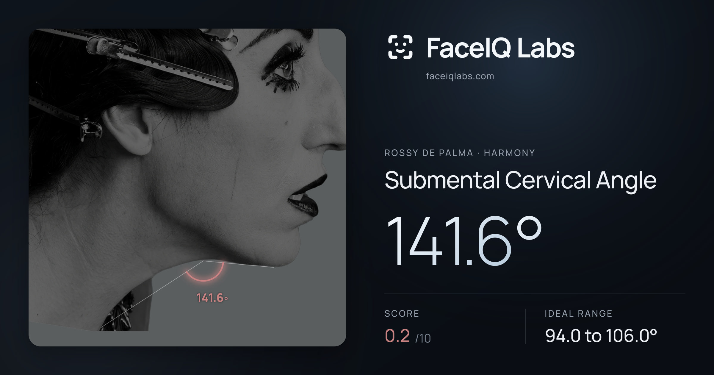 Rossy De Palma Submental Cervical Angle: 141.6°, drawn on the photo