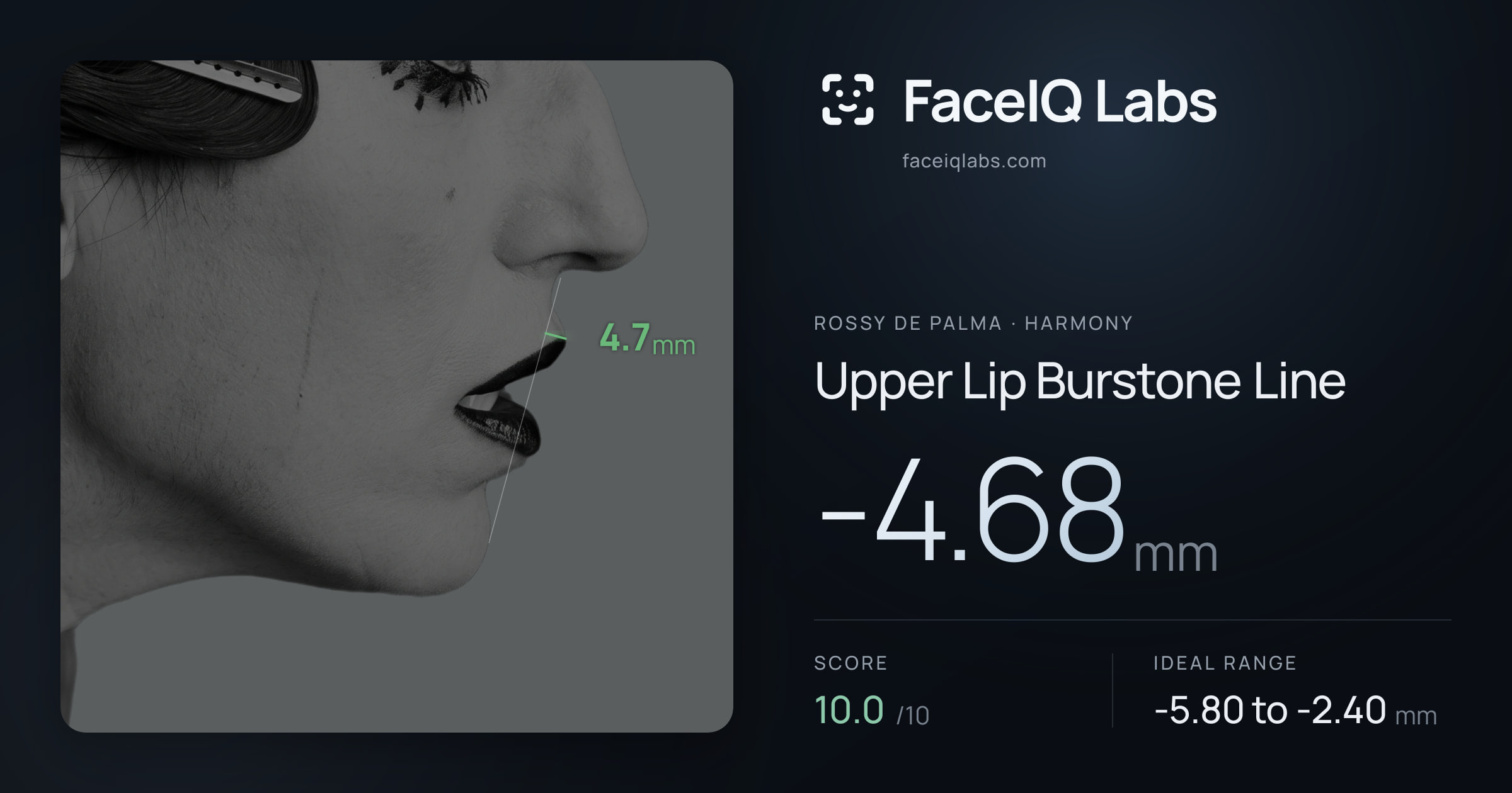 Rossy De Palma Upper Lip Burstone Line: -4.68mm, drawn on the photo