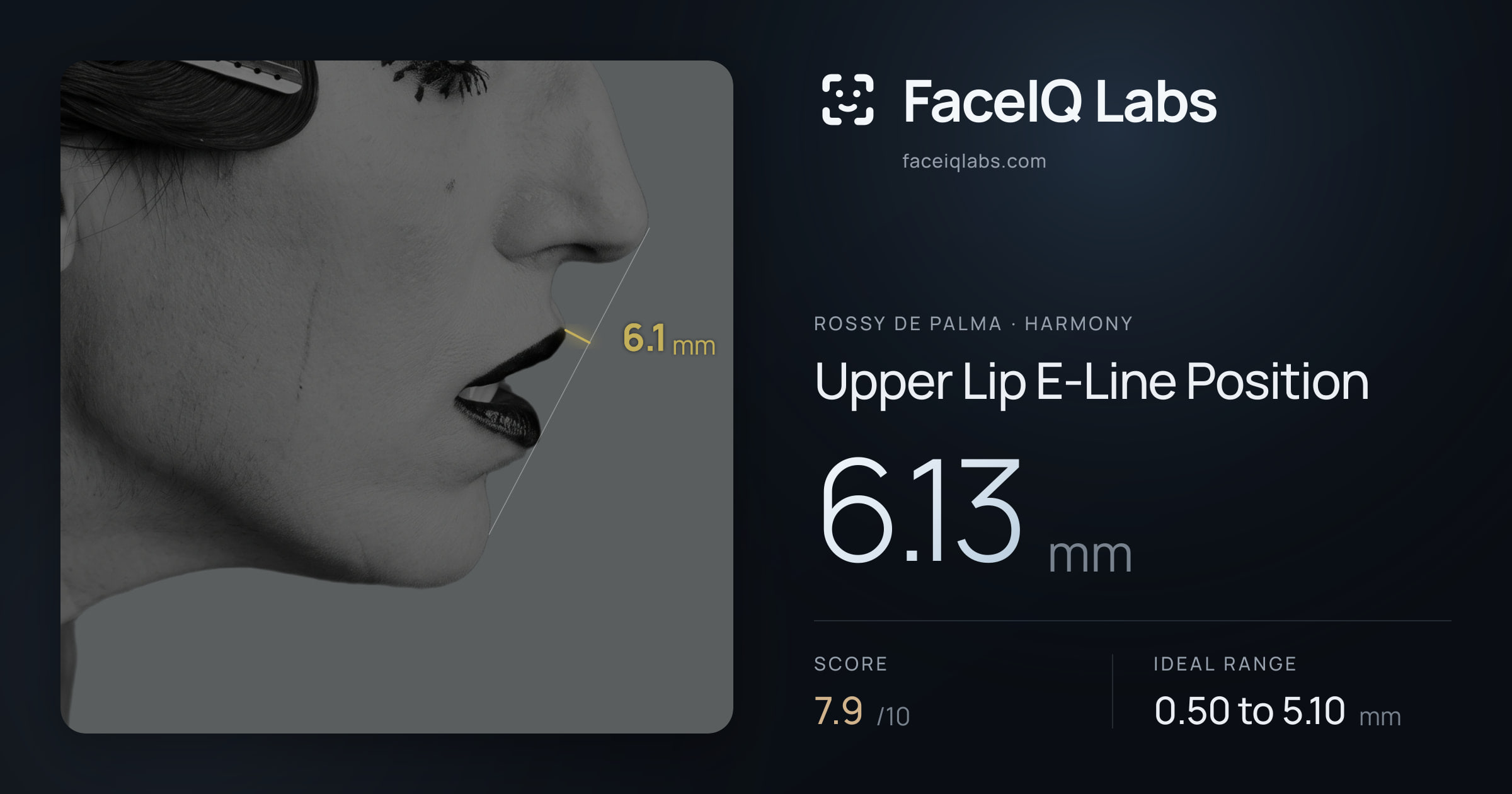 Rossy De Palma Upper Lip E-Line Position: 6.13mm, drawn on the photo