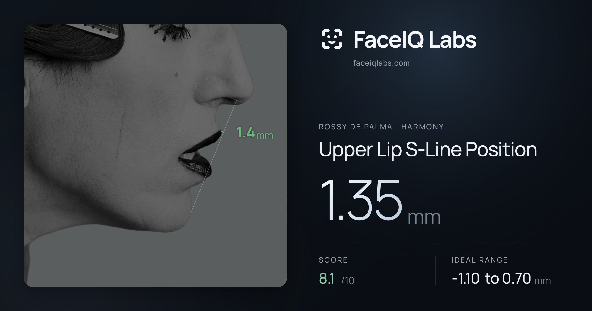 Rossy De Palma Upper Lip S-Line Position: 1.35mm, drawn on the photo