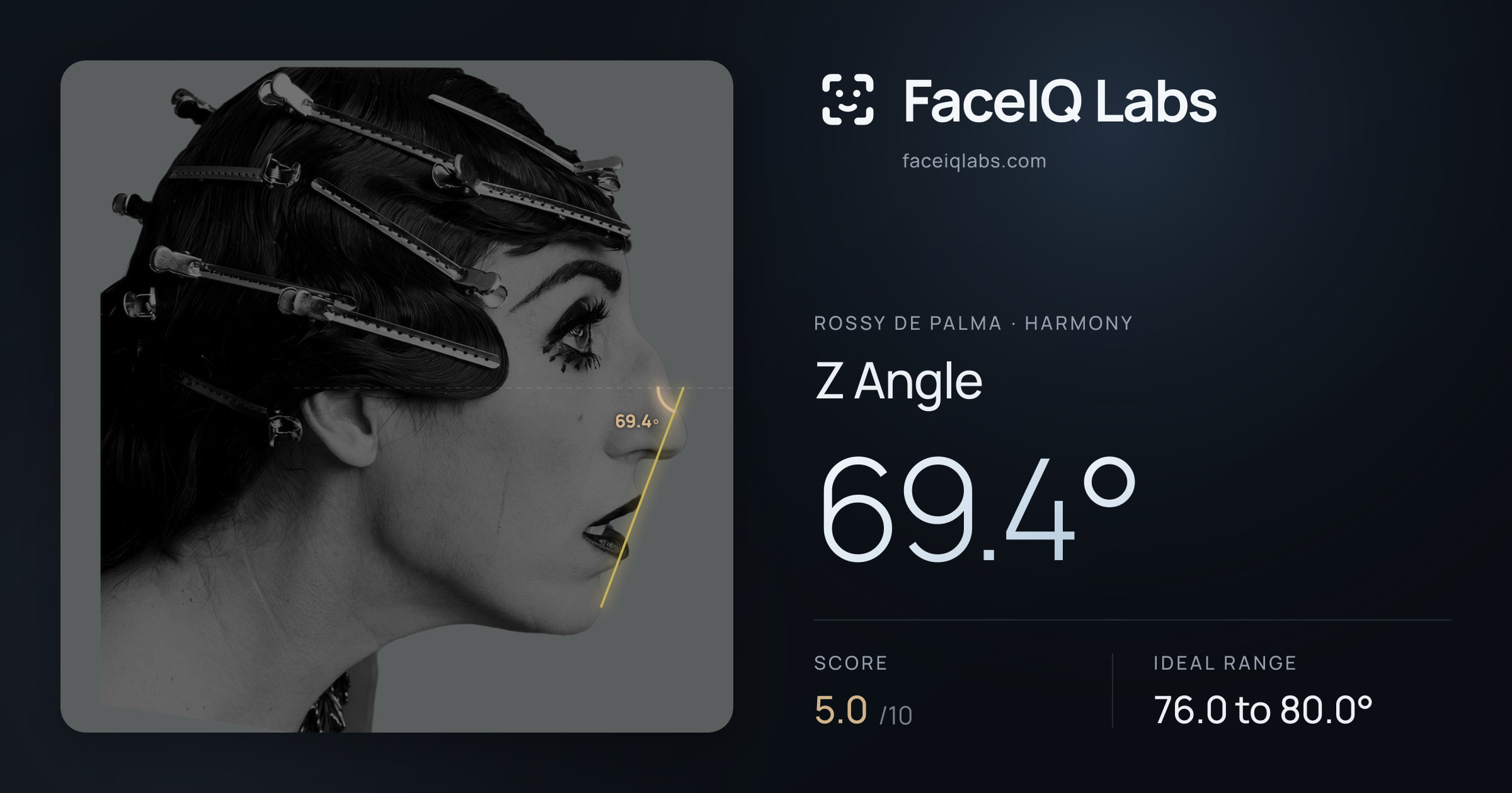 Rossy De Palma Z Angle: 69.4°, drawn on the photo