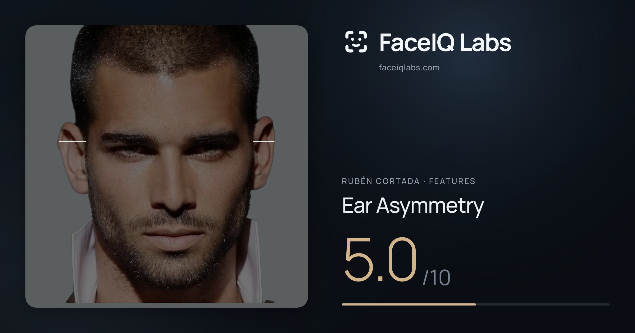Rubén Cortada Ear Asymmetry: 5.0/10, drawn on the photo
