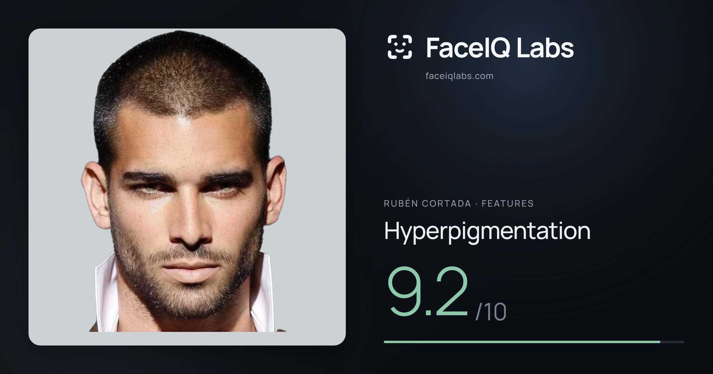 Rubén Cortada Hyperpigmentation: 9.2/10, drawn on the photo