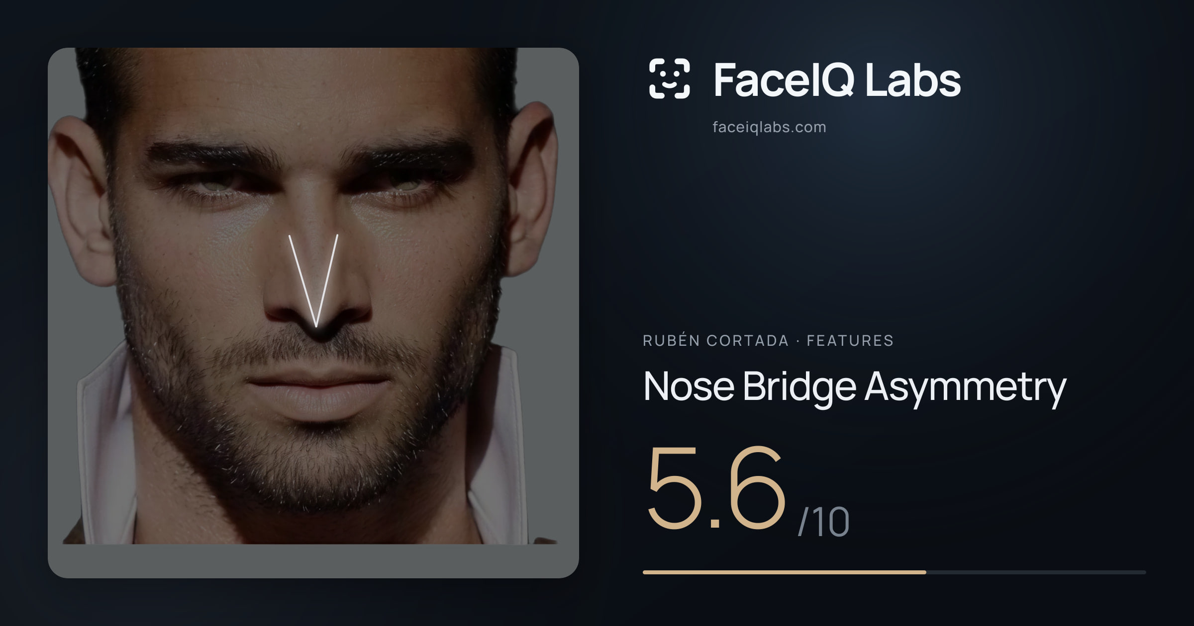 Rubén Cortada Nose Bridge Asymmetry: 5.6/10, drawn on the photo