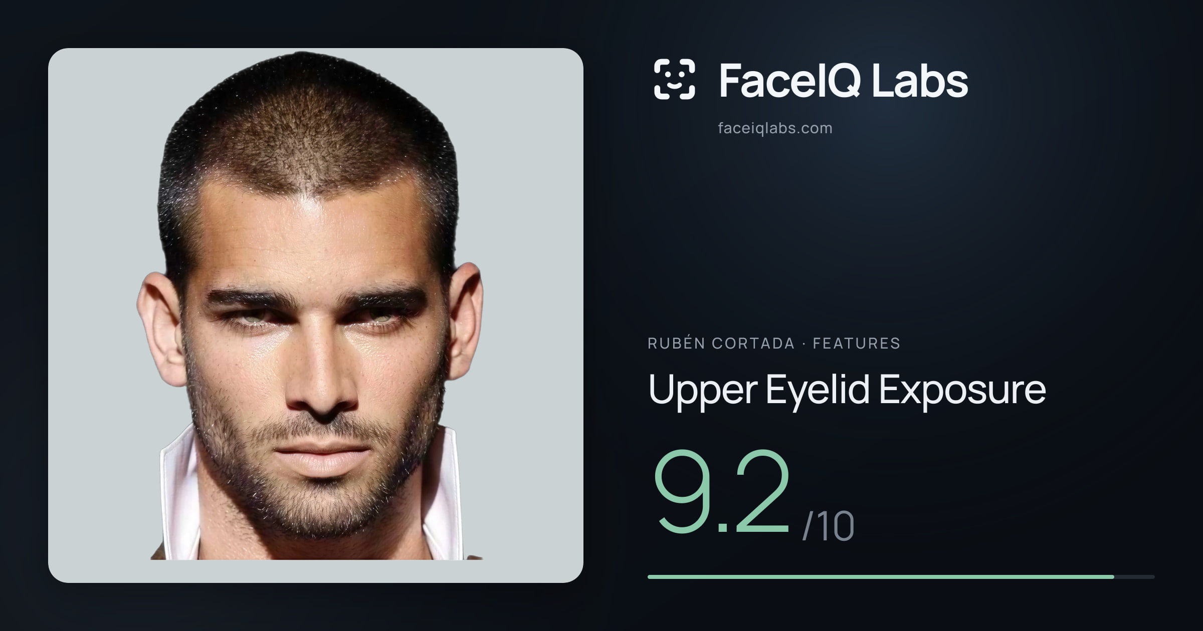 Rubén Cortada Upper Eyelid Exposure: 9.2/10, drawn on the photo