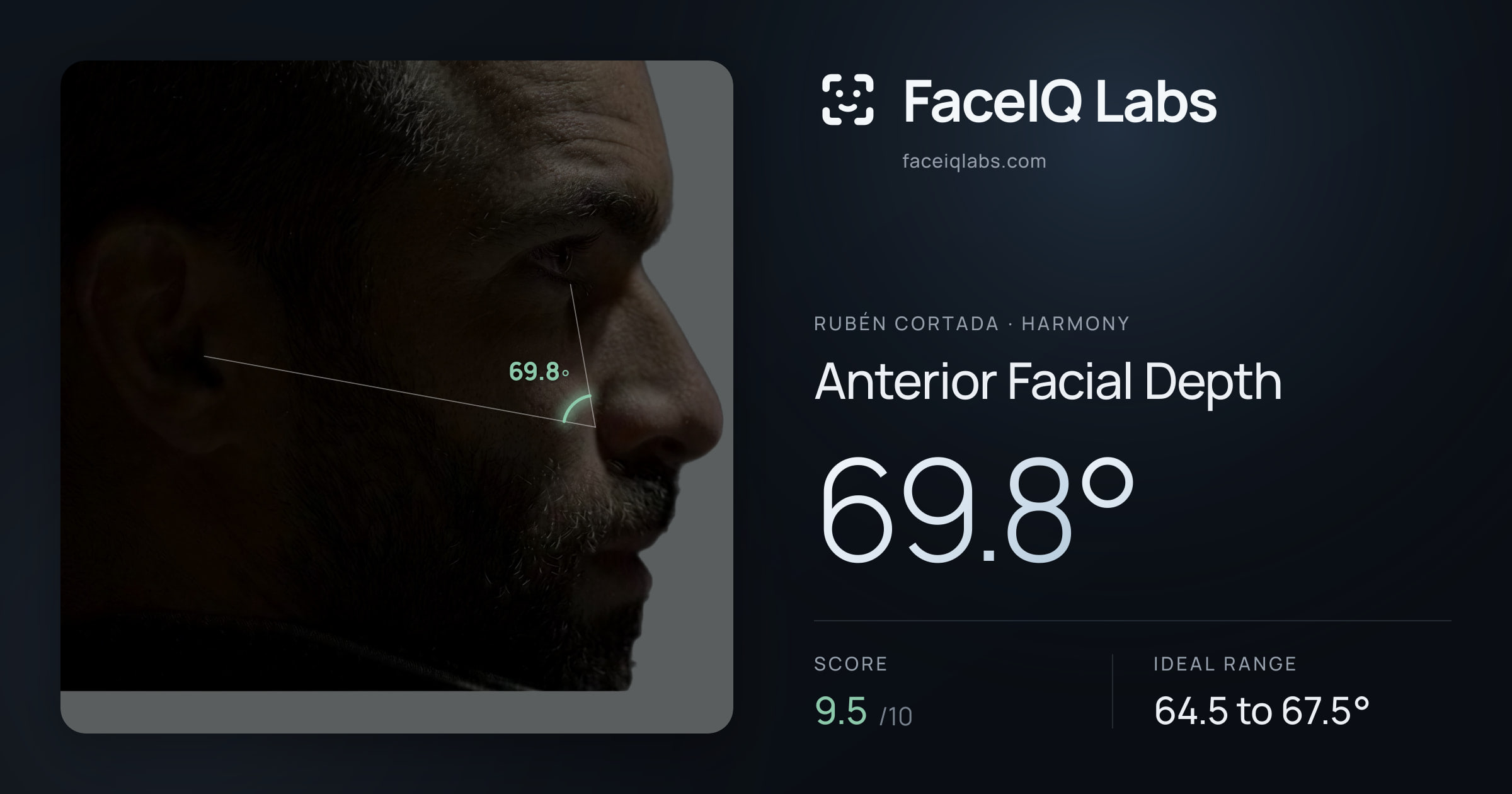 Rubén Cortada Anterior Facial Depth: 69.8°, drawn on the photo