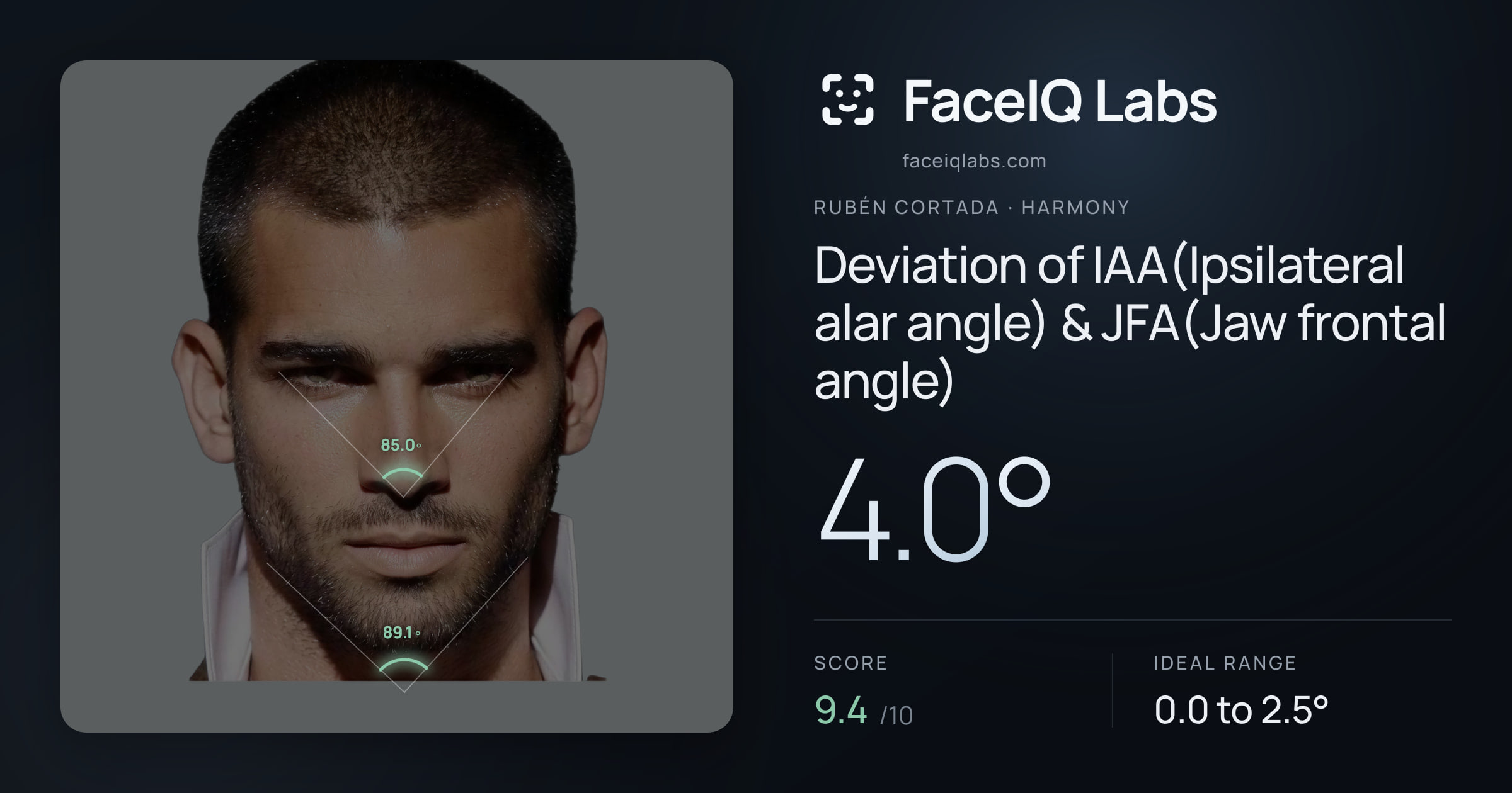 Rubén Cortada Deviation of IAA(Ipsilateral alar angle) & JFA(Jaw frontal angle): 4.0°, drawn on the photo