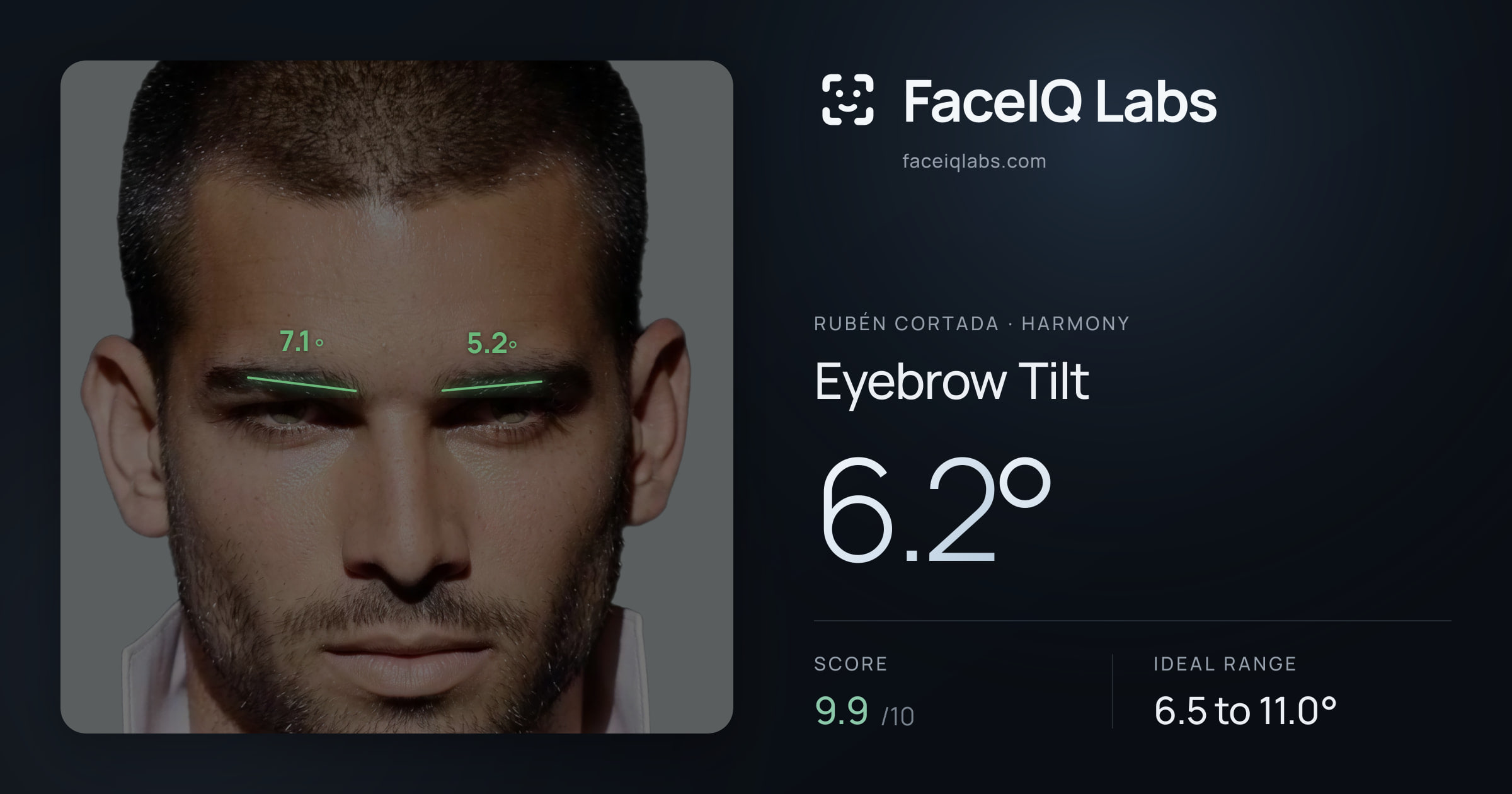 Rubén Cortada Eyebrow Tilt: 6.2°, drawn on the photo