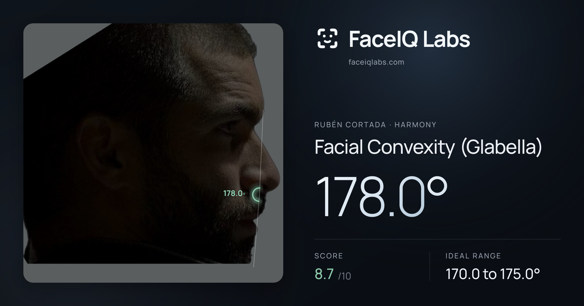 Rubén Cortada Facial Convexity (Glabella): 178.0°, drawn on the photo