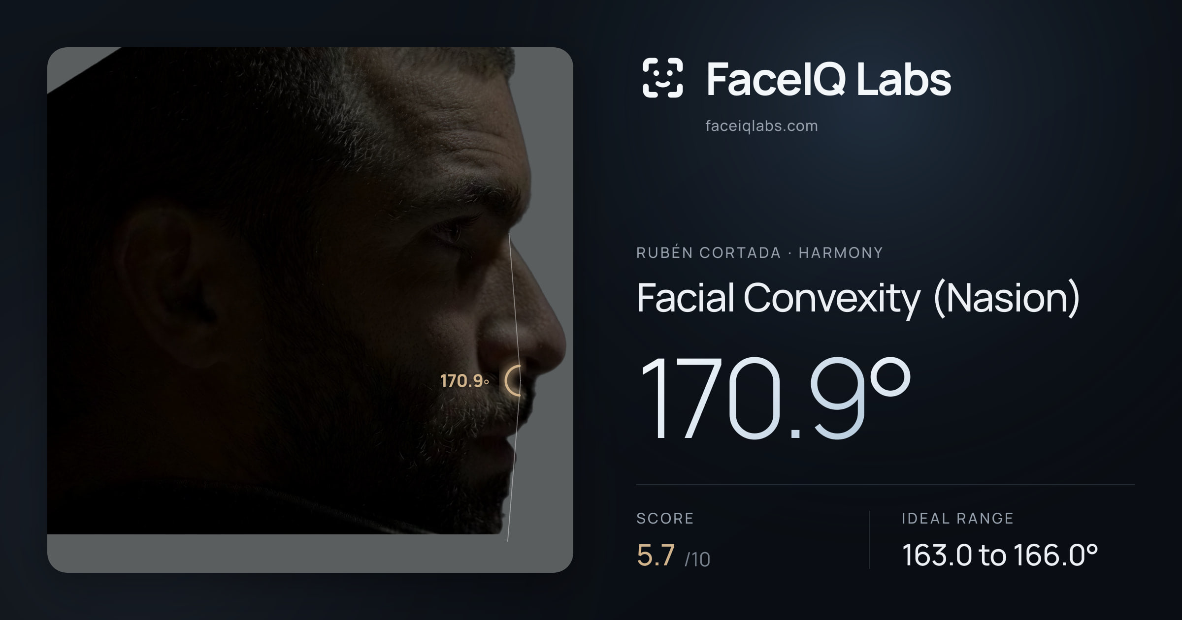 Rubén Cortada Facial Convexity (Nasion): 170.9°, drawn on the photo