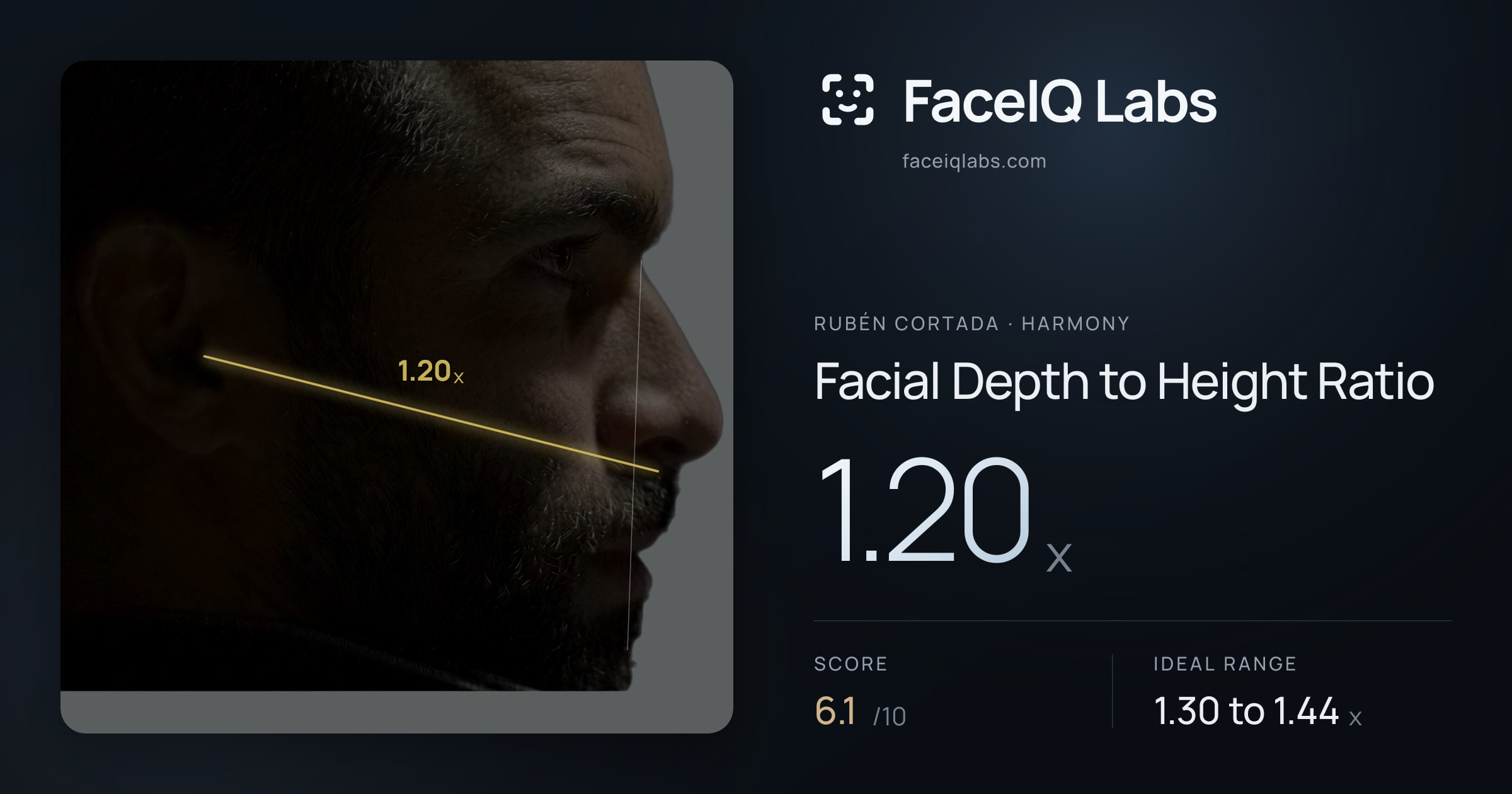 Rubén Cortada Facial Depth to Height Ratio: 1.20x, drawn on the photo